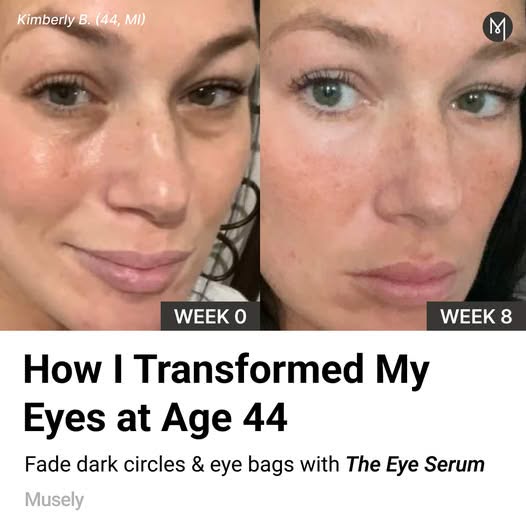 Musely FaceRx Facebook ad