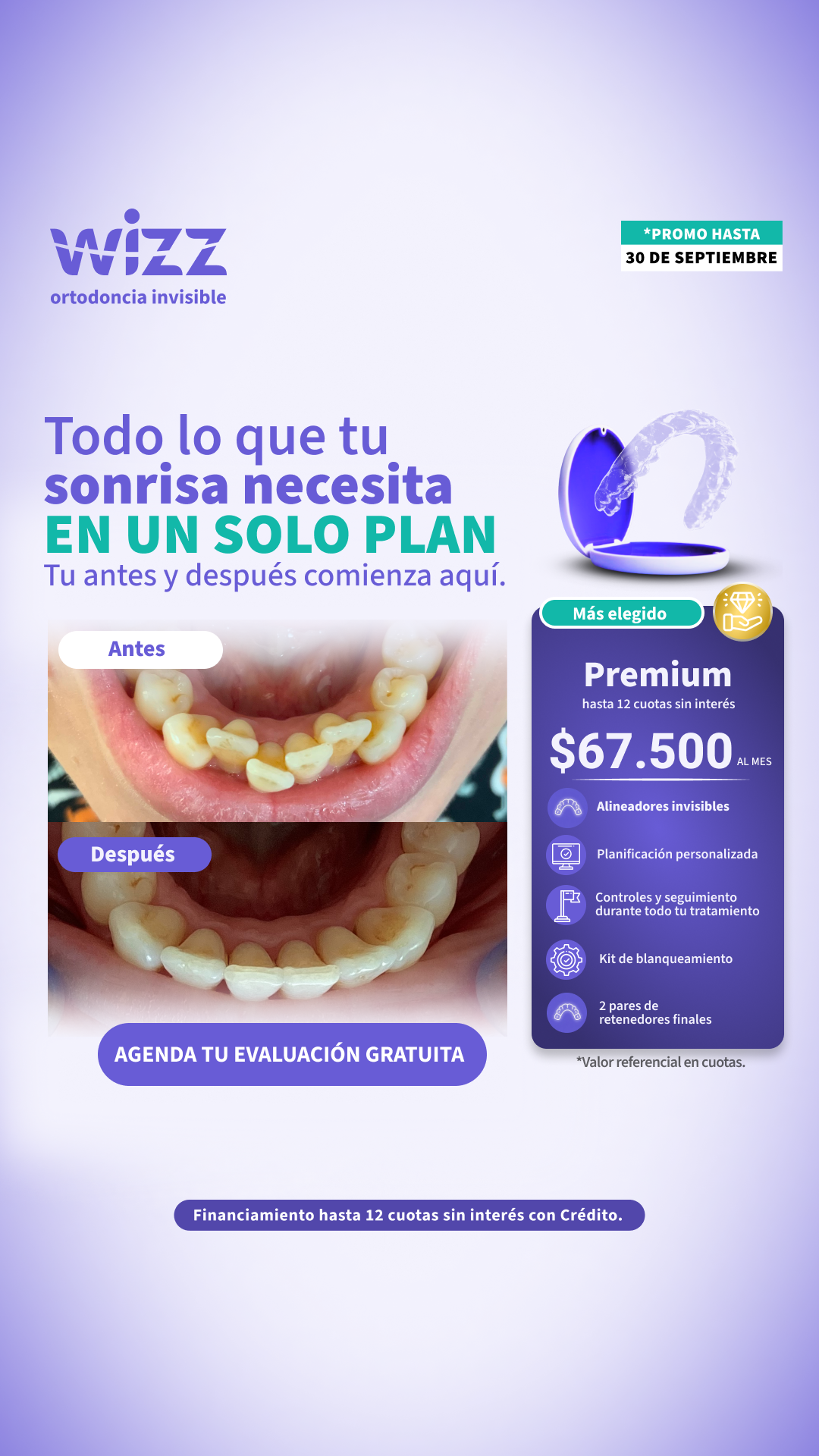 Wizz Chile Facebook ad: Corrige tu sonrisa con alineadores invisibles guiados por…