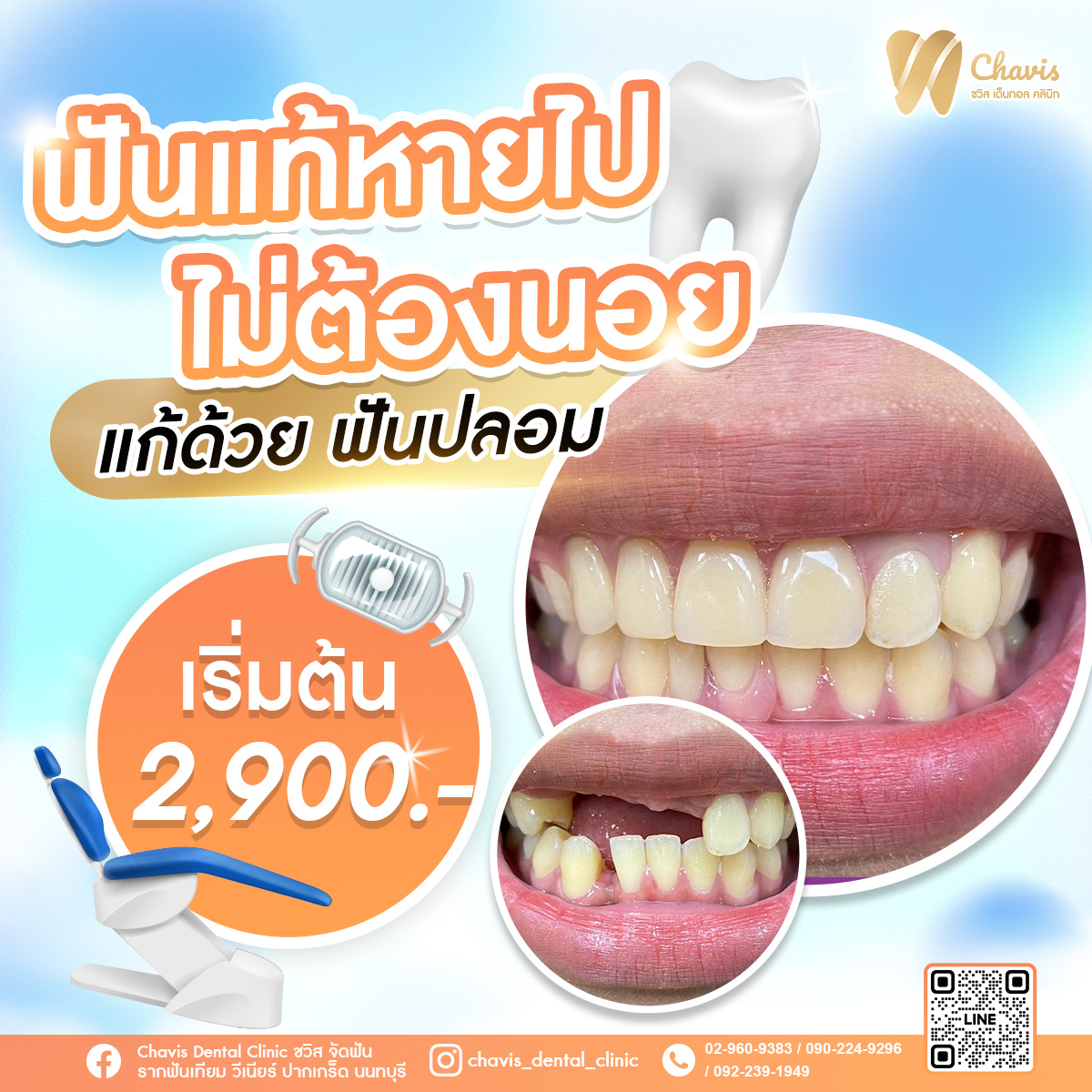 Chavis Dental Clinic ชวิสเด็นทอล คลินิกทันตกรรม ปากเกร็ด นนทบุรี Facebook ad: ฟันแท้หายไม่ต้องนอย มาที่ 𝐂𝐡𝐚𝐯𝐢𝐬 มีทางแก้แน่นอน