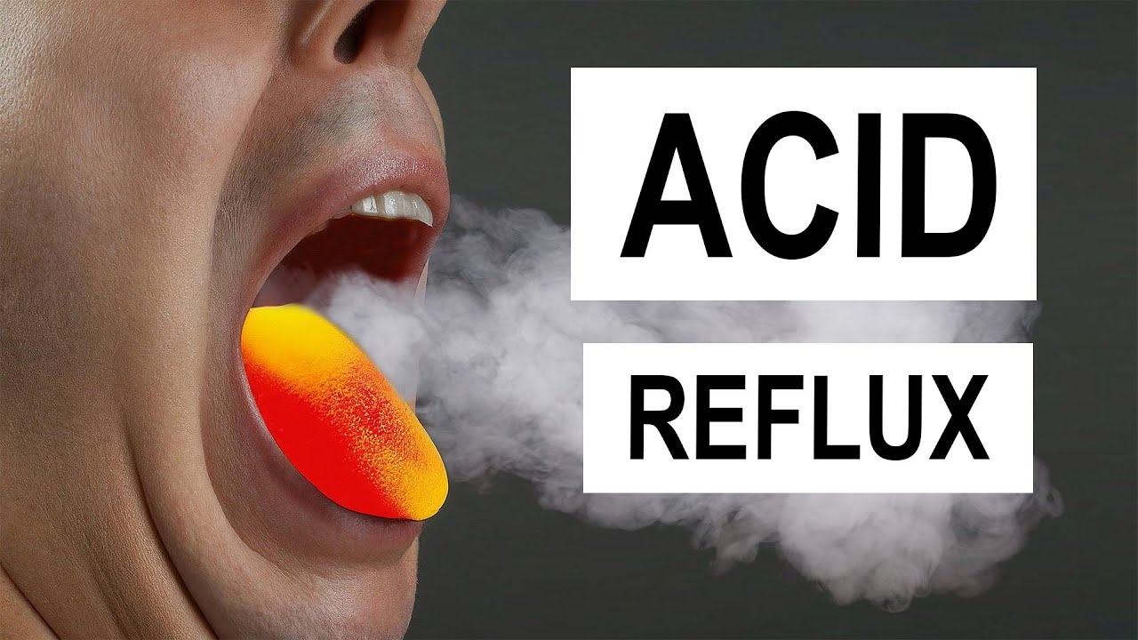 Dr. Patricia Moore PhD Facebook ad: Your Acid Reflux Isn’t an Acid Problem