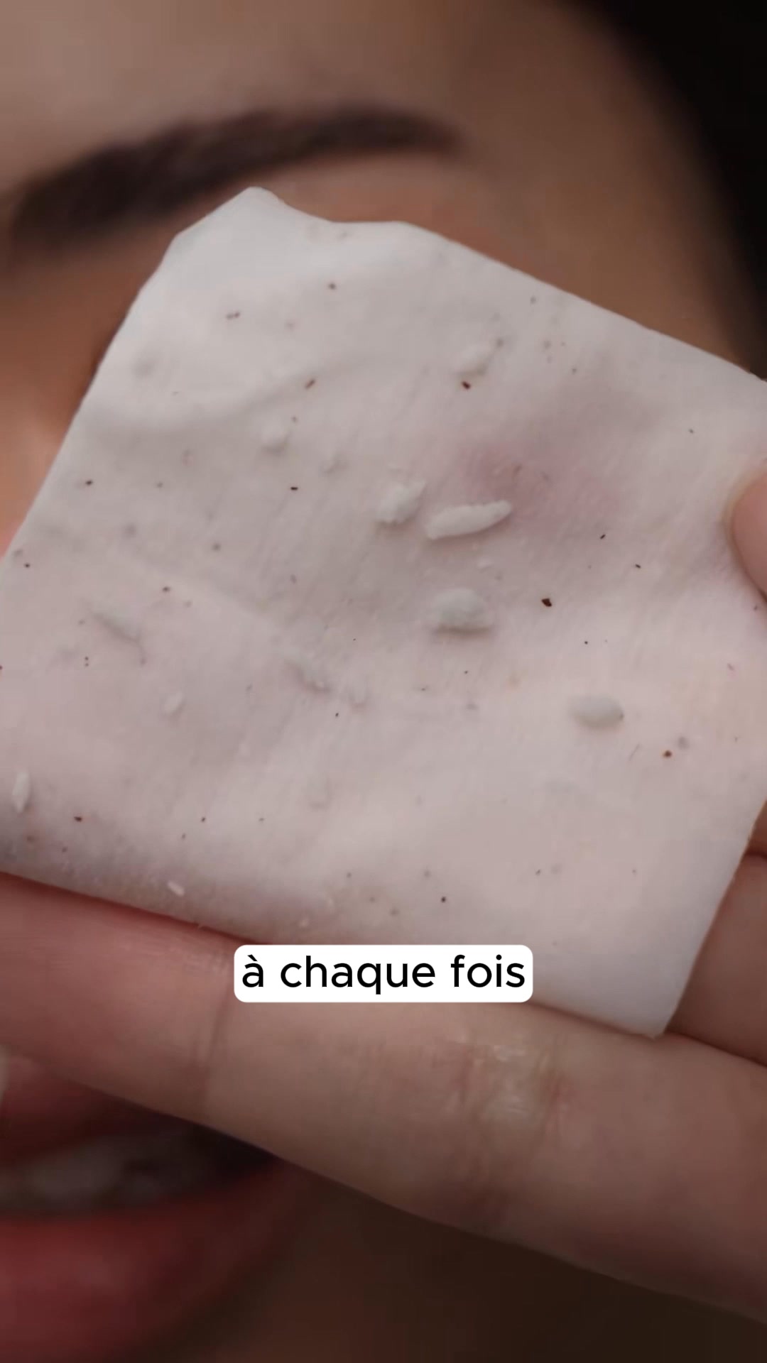Soelia Facebook ad: Dites Adieu aux Points Noirs