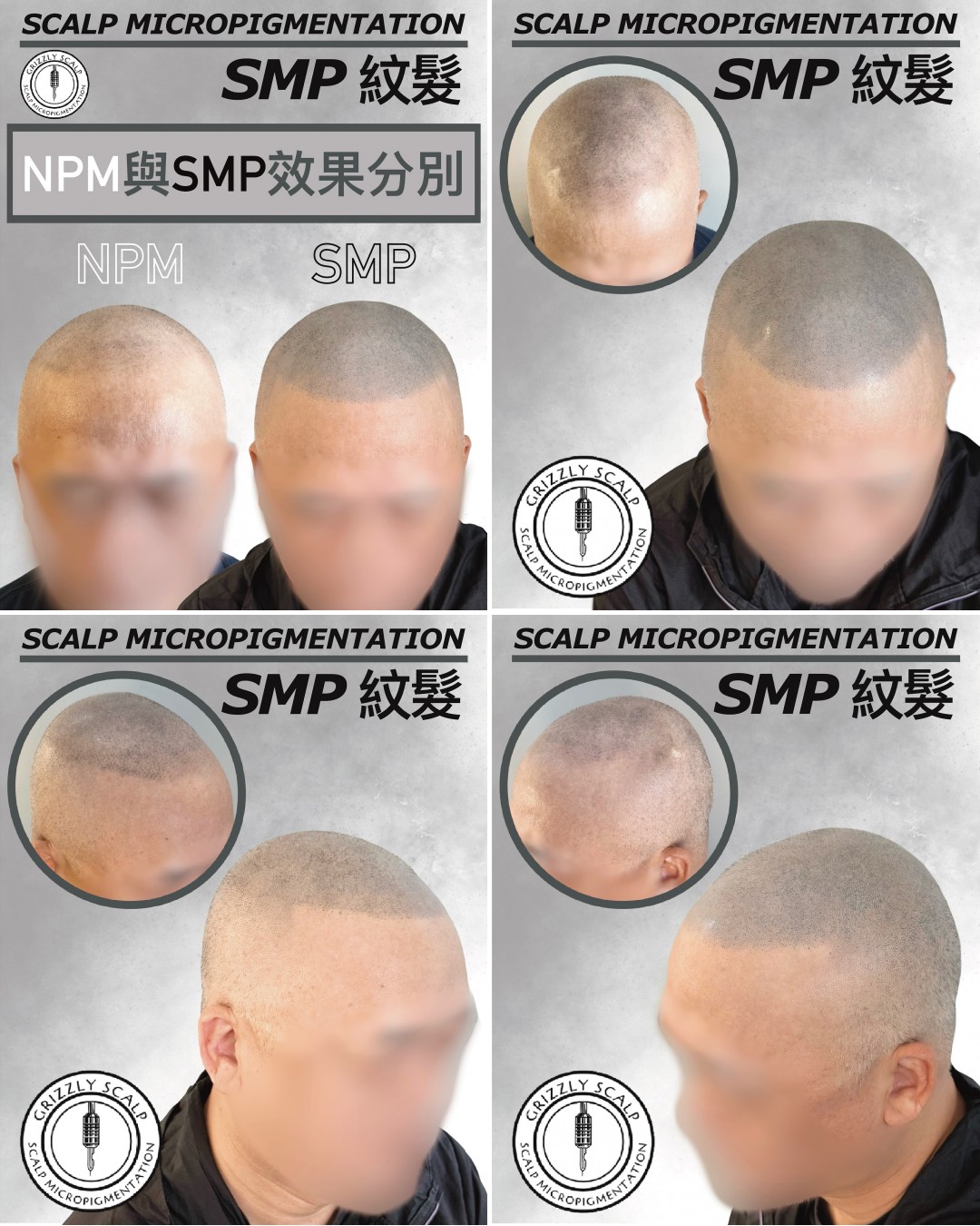 Grizzly Scalp 紋髮 Bob Ng Facebook ad