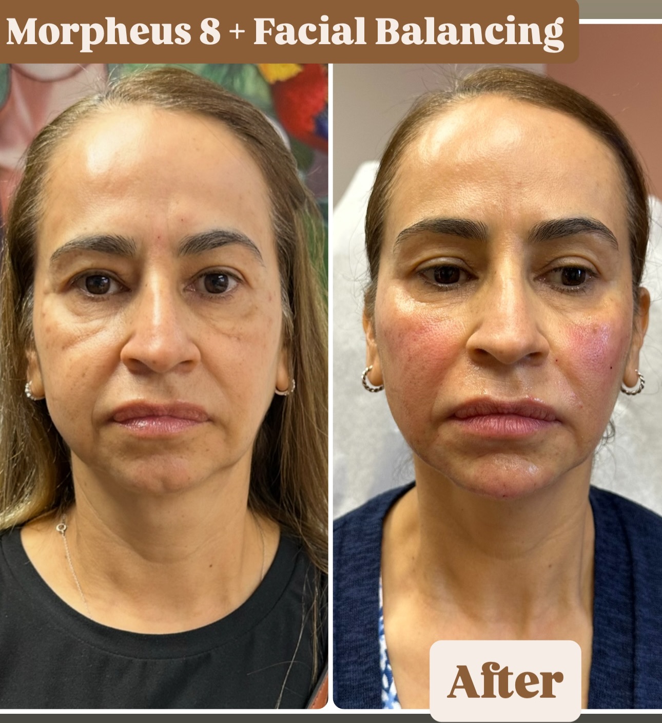 Dash of Fab Med Spa Facebook ad