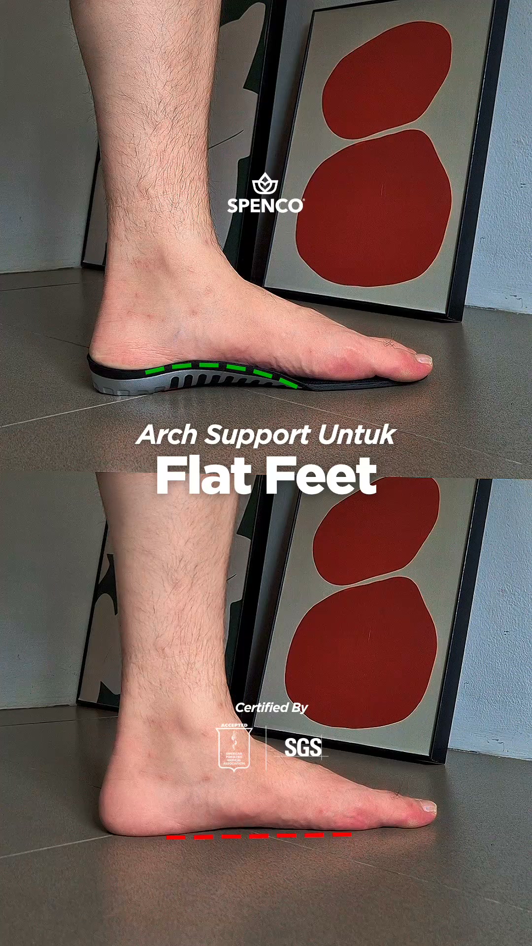 Spenco a foot health products for reducing pain and increase mobility Facebook ad: Lengkung kaki butuh support yang tepat untuk distribusi…