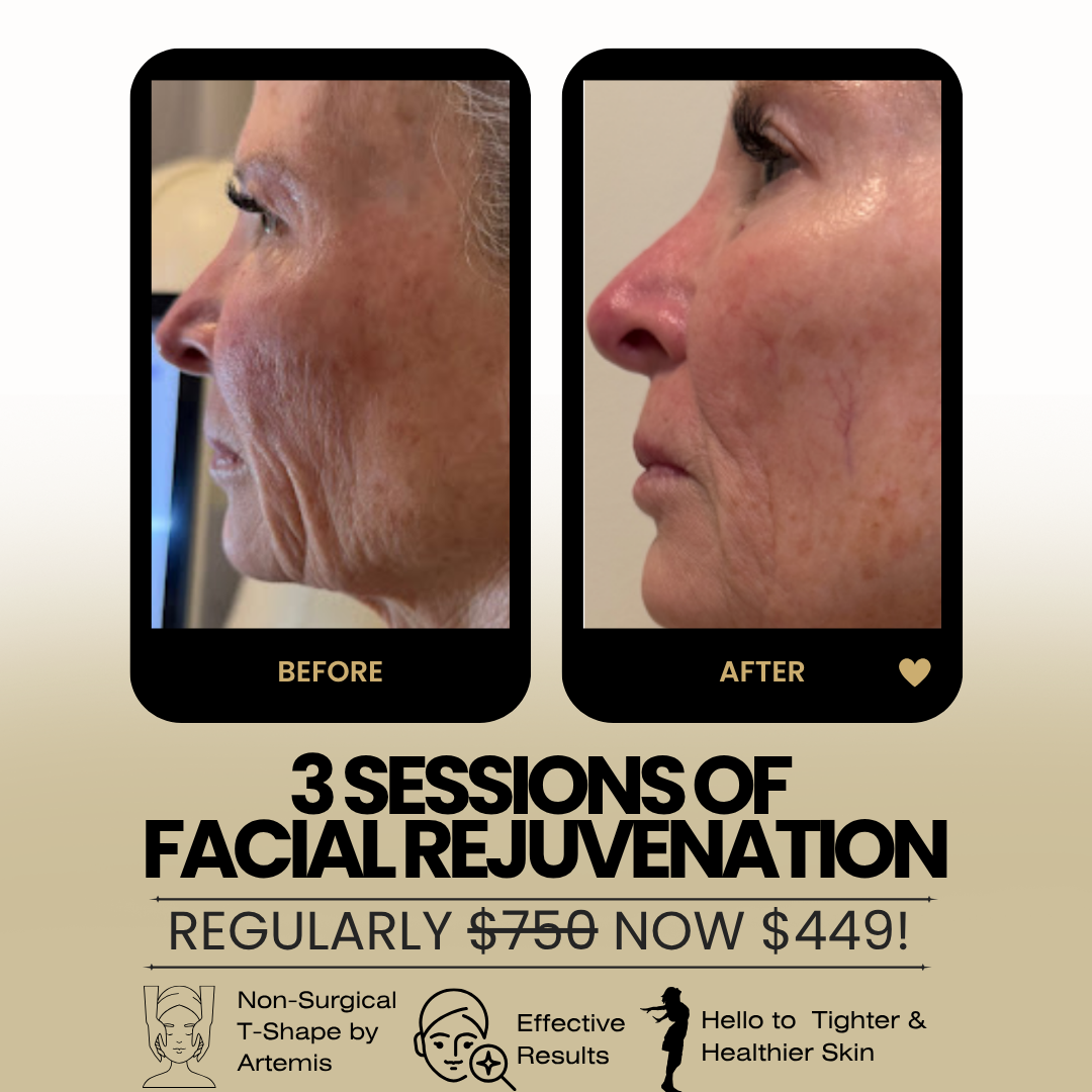 Glow By Laser Facebook ad: Smooth, Radiant Skin in 3 Visits
