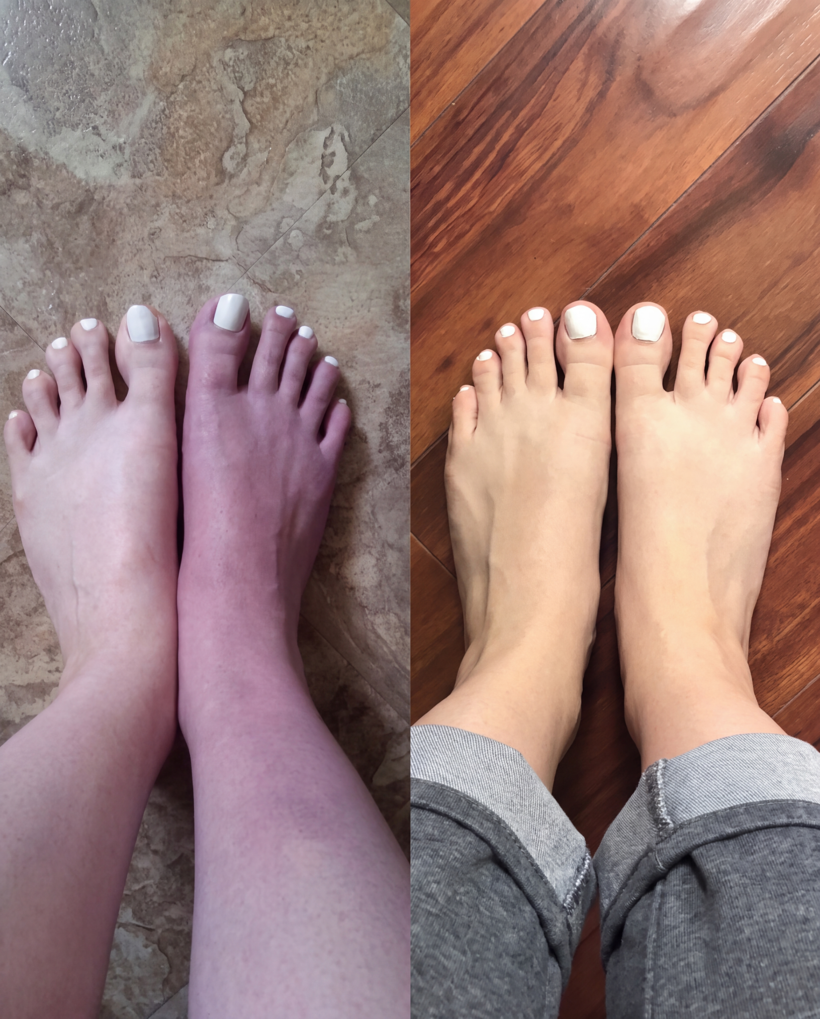 Dr. Benjamin Carter, MD Facebook ad: Put an End to Neuropathy Pain for Good?