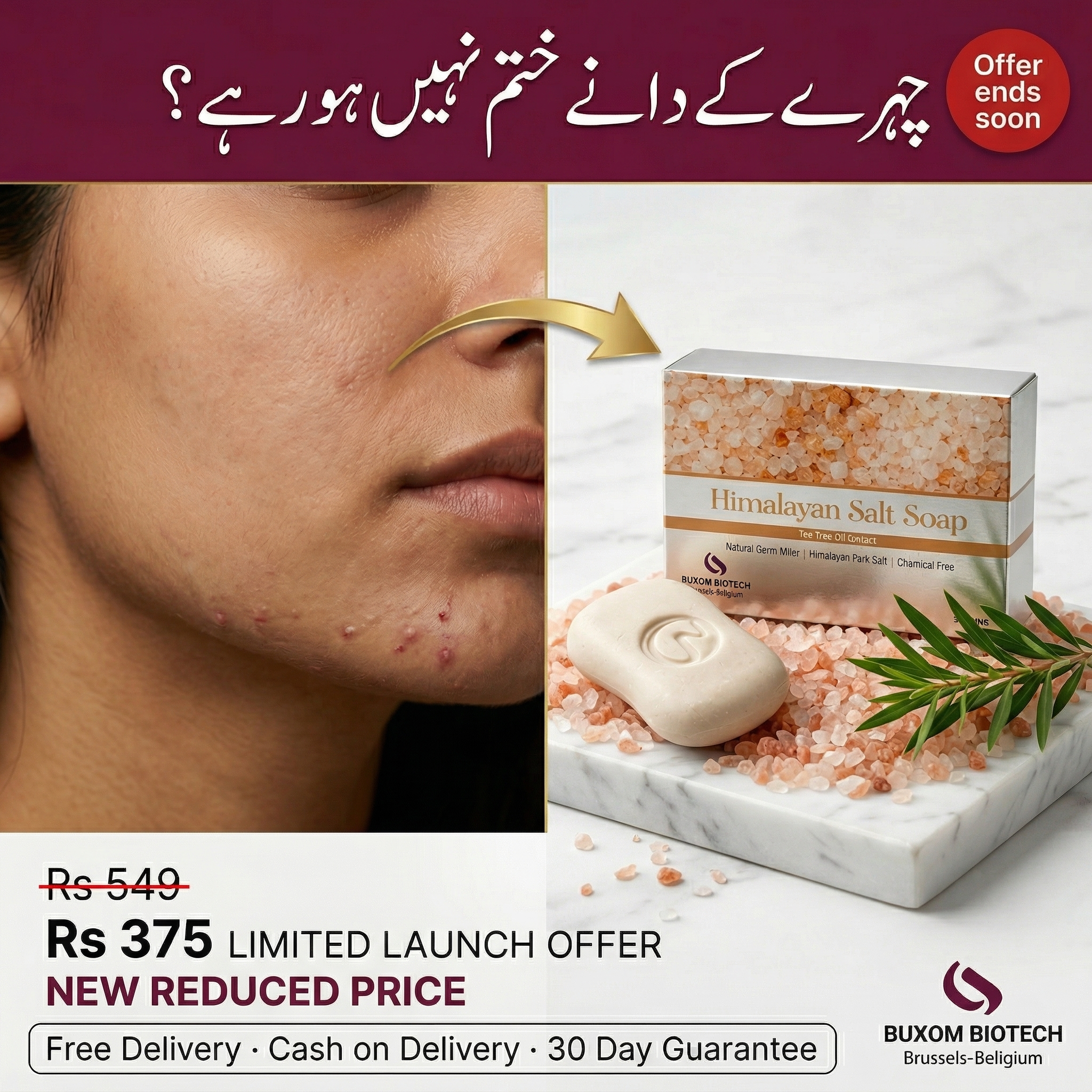 Buxom Biotech Facebook ad: Body Acne Ka Natural Ilaaj -