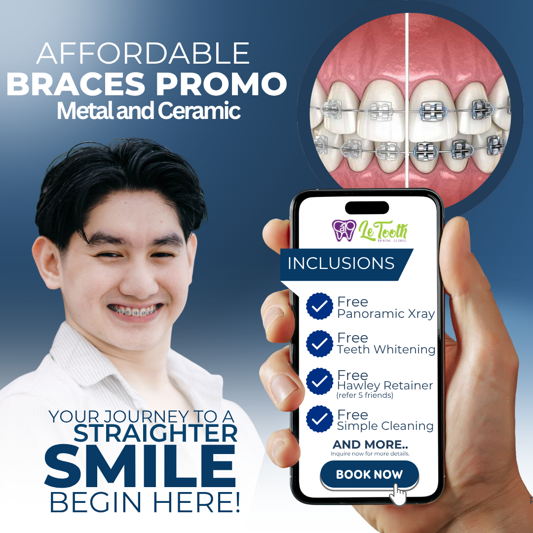 SA19 Le Tooth Dental Clinic Facebook ad from Jun 21, 2026