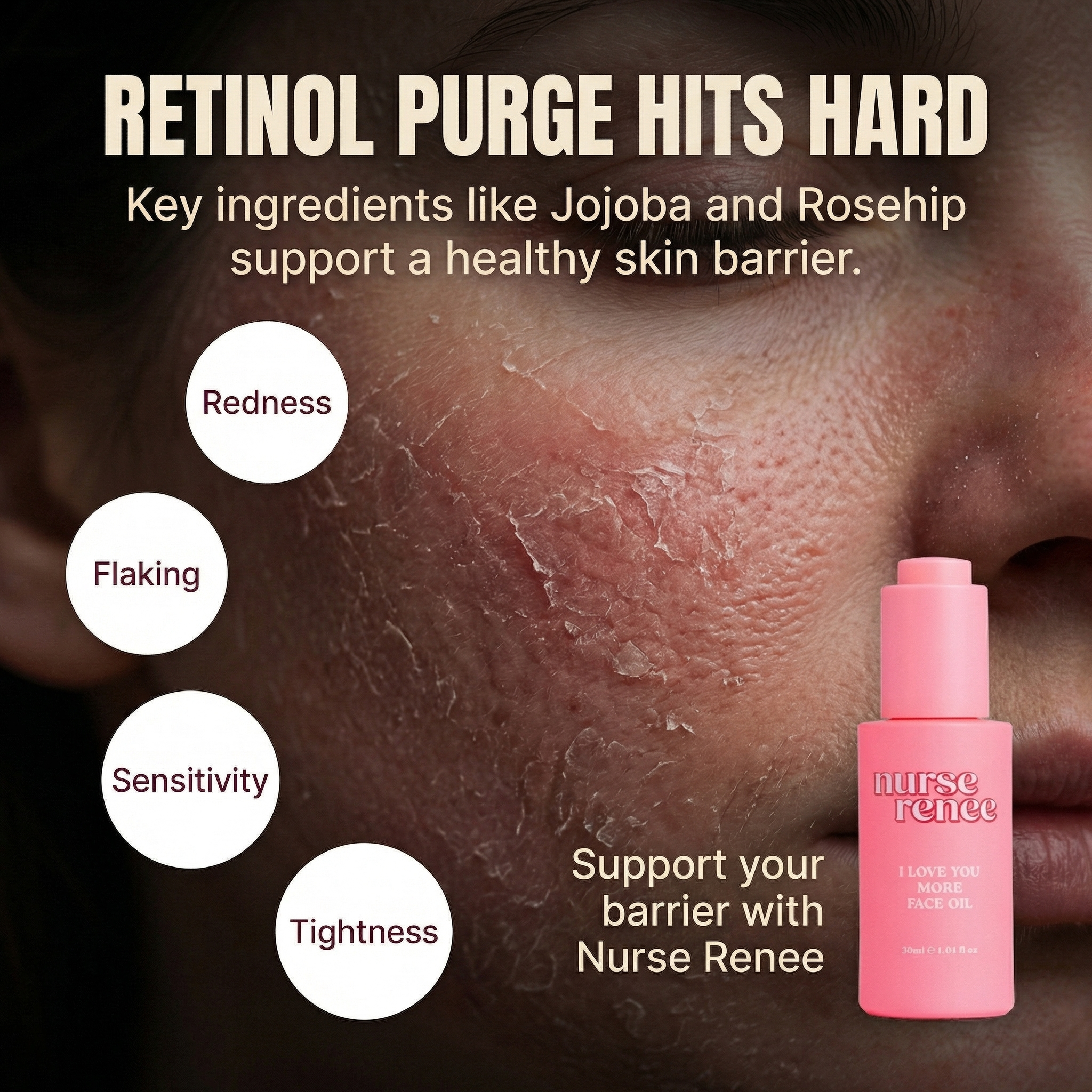 Nurse Renee Facebook ad