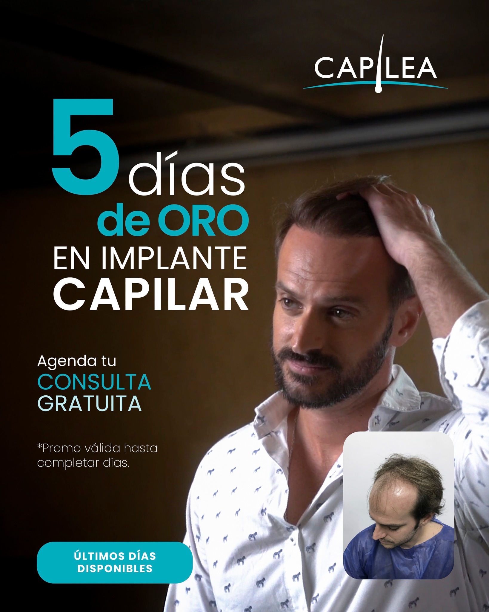 Capilea Madrid Facebook ad: Los 5 Días de Oro de Capilea ya…