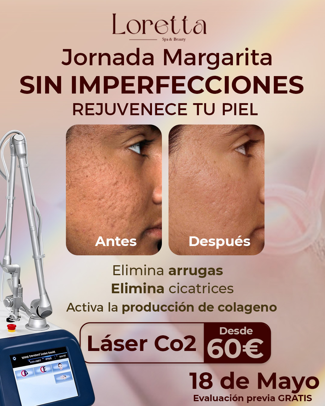 Loretta Spa Facebook ad: Chatea con nosotros