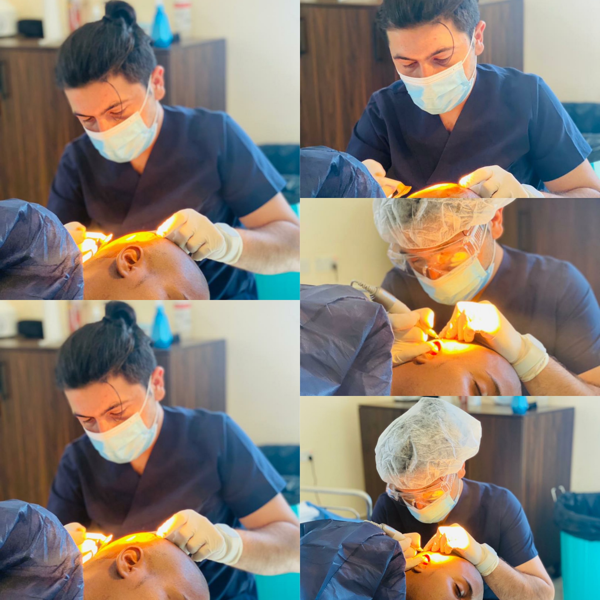 Oktay Yavuz Hair Transplant Clinic Facebook ad: Unapoteza nywele au ndevu?