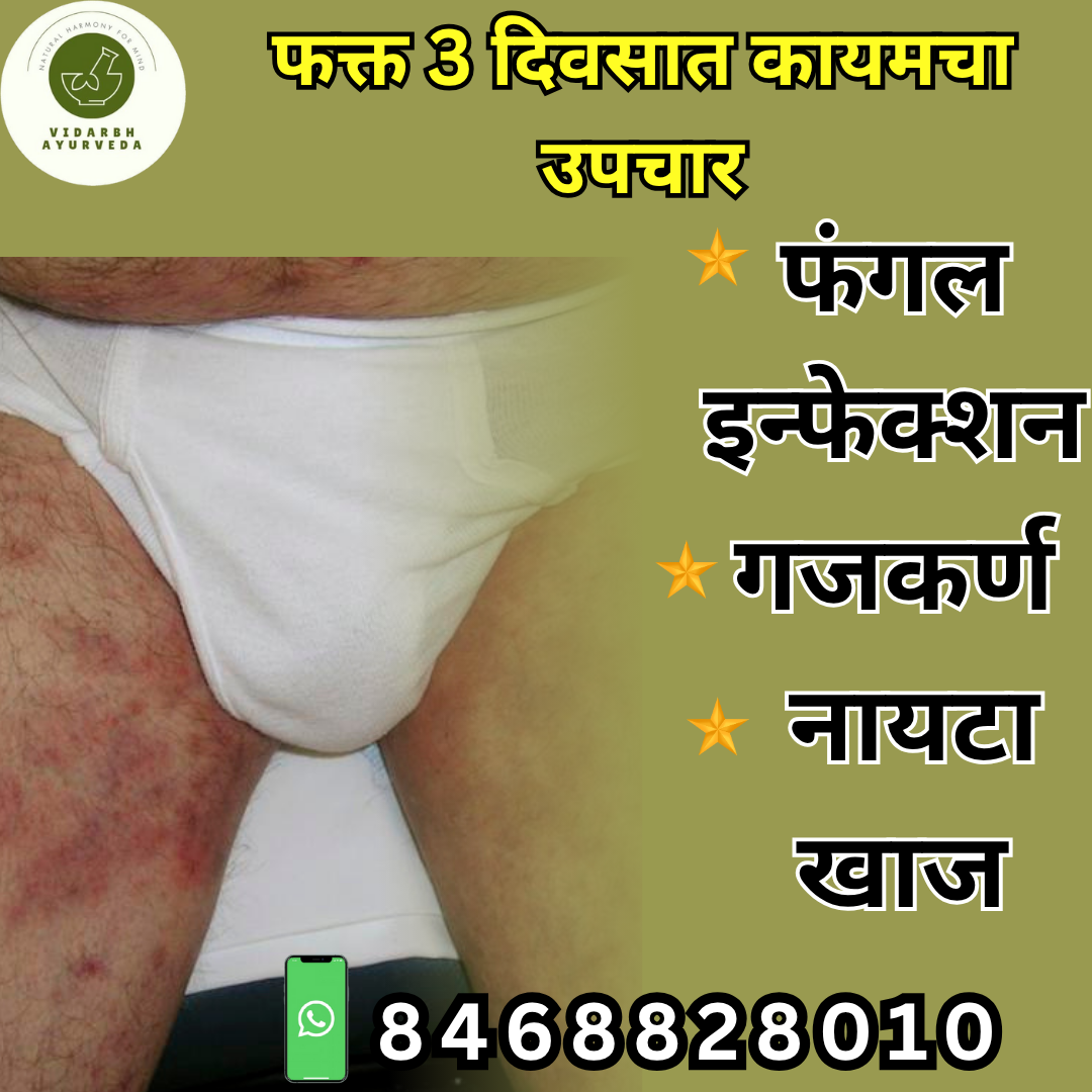 Vidharbh आयुर्वेदा Facebook ad: FOR HOME DELIVERY