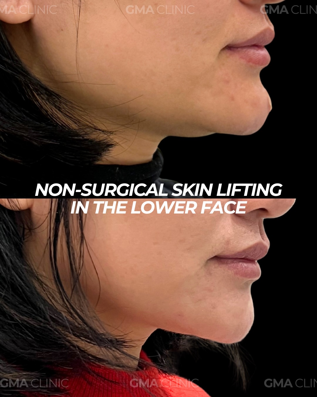 GMA Clinic Facebook ad