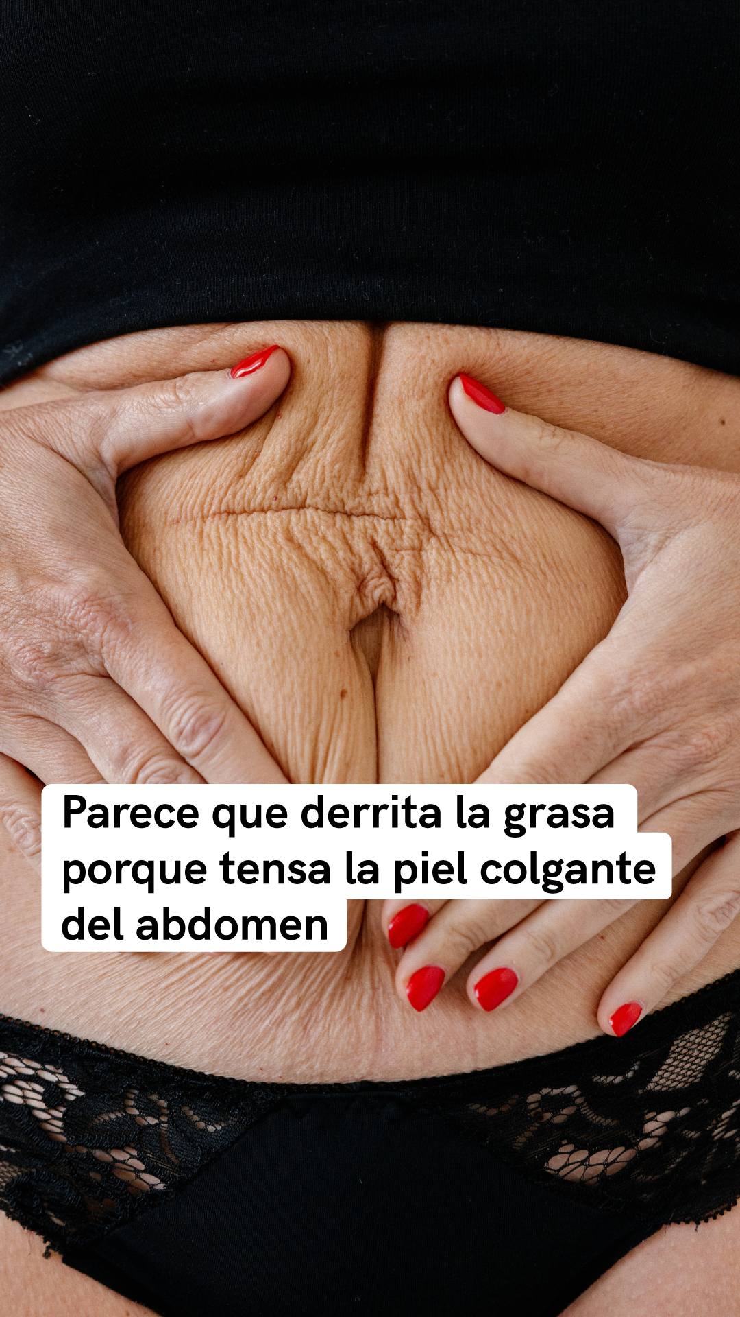 Masderm Facebook ad