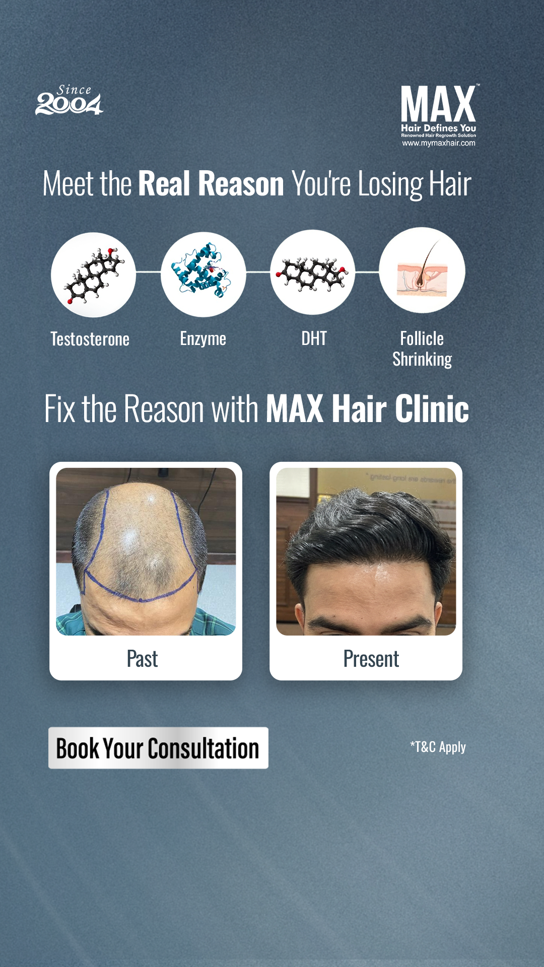 MAX Hair Clinic Facebook ad