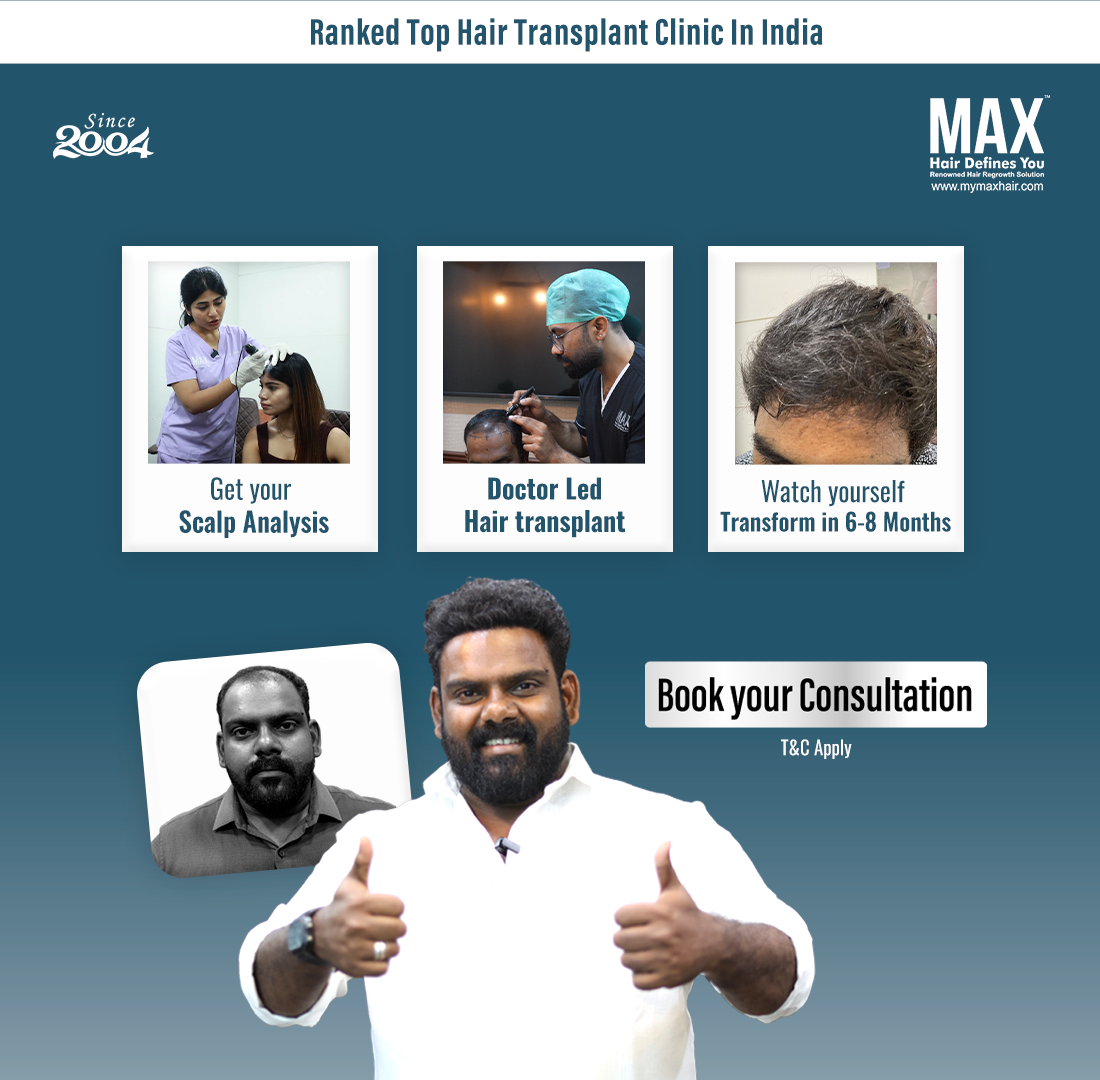 MAX Hair Clinic Facebook ad