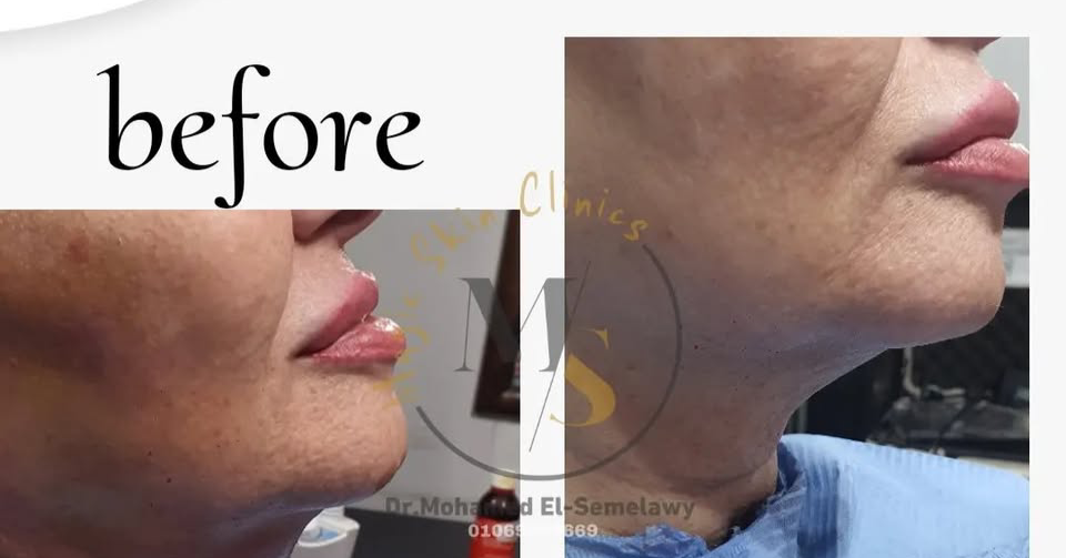Magic skin clinics Facebook ad