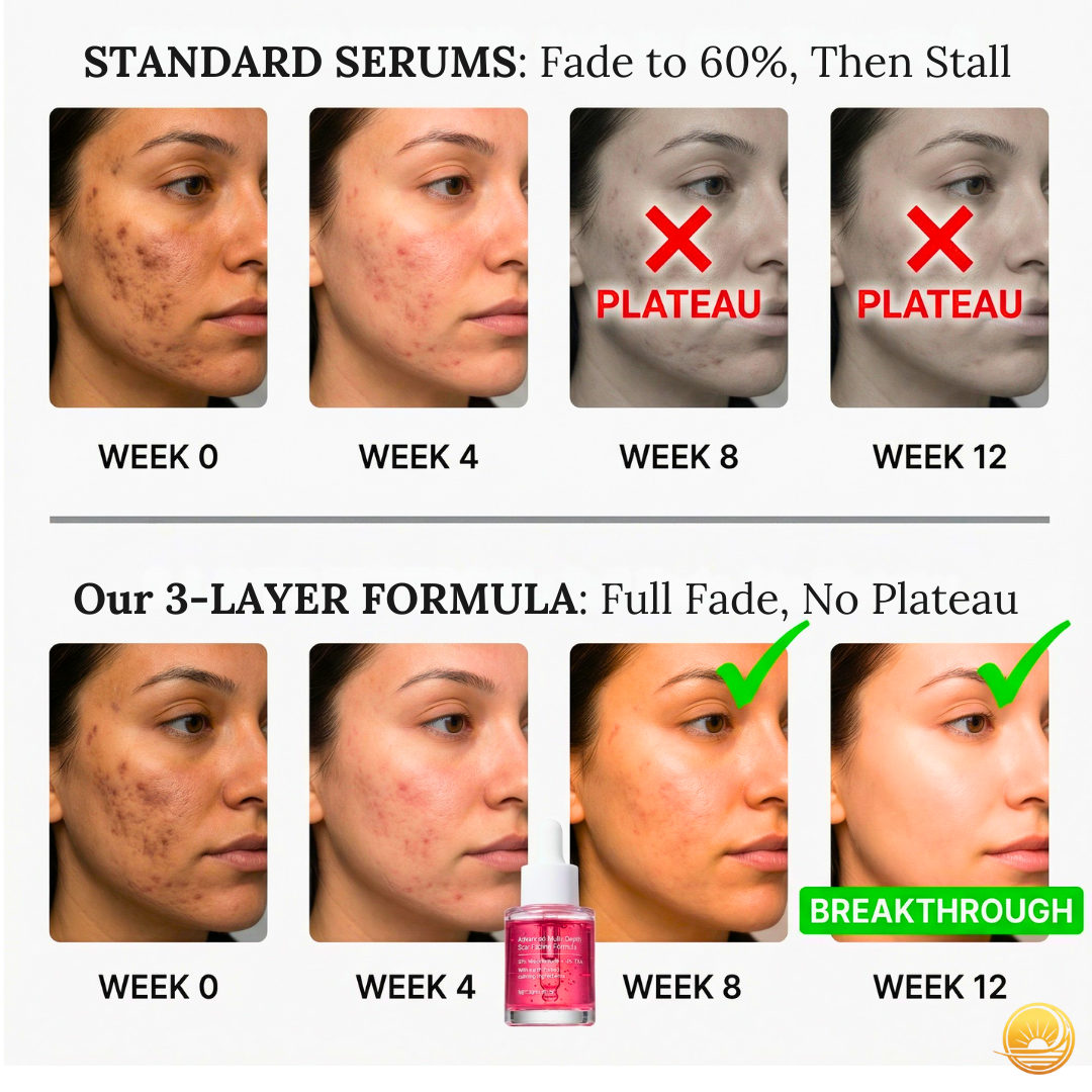 Terraura Facebook ad: Finally, a Serum That Finishes the Job