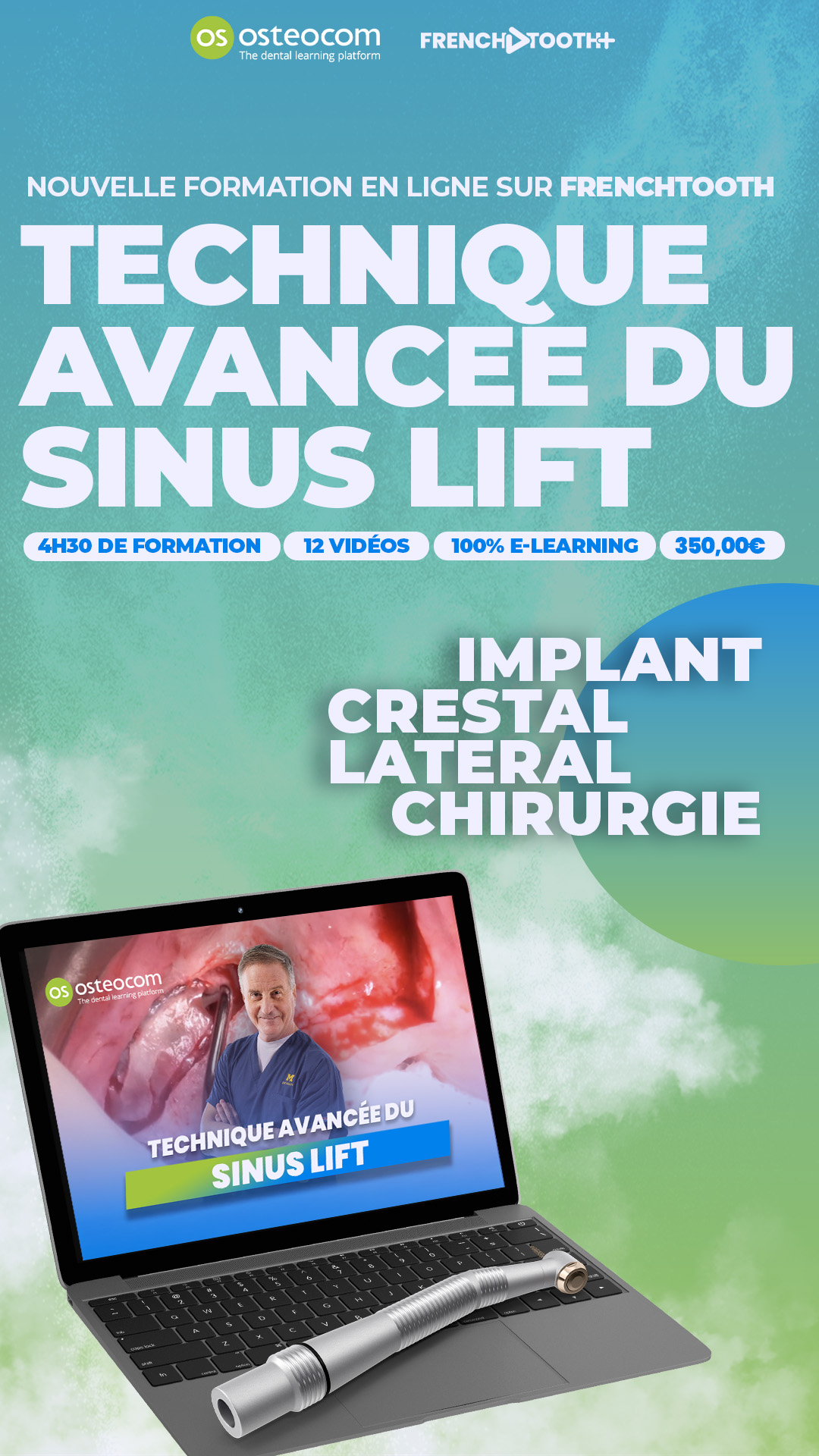 French Tooth Facebook ad
