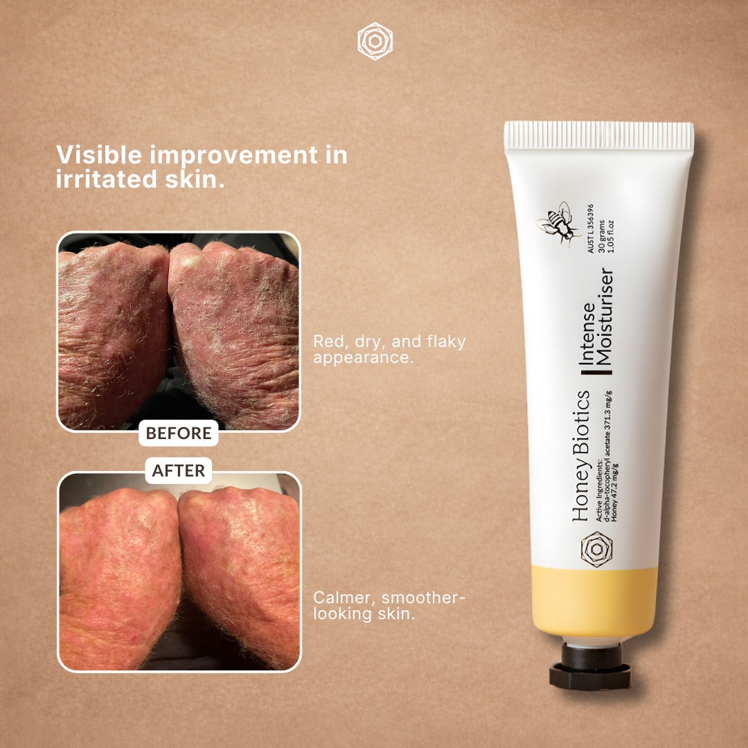 Honey Biotics Facebook ad
