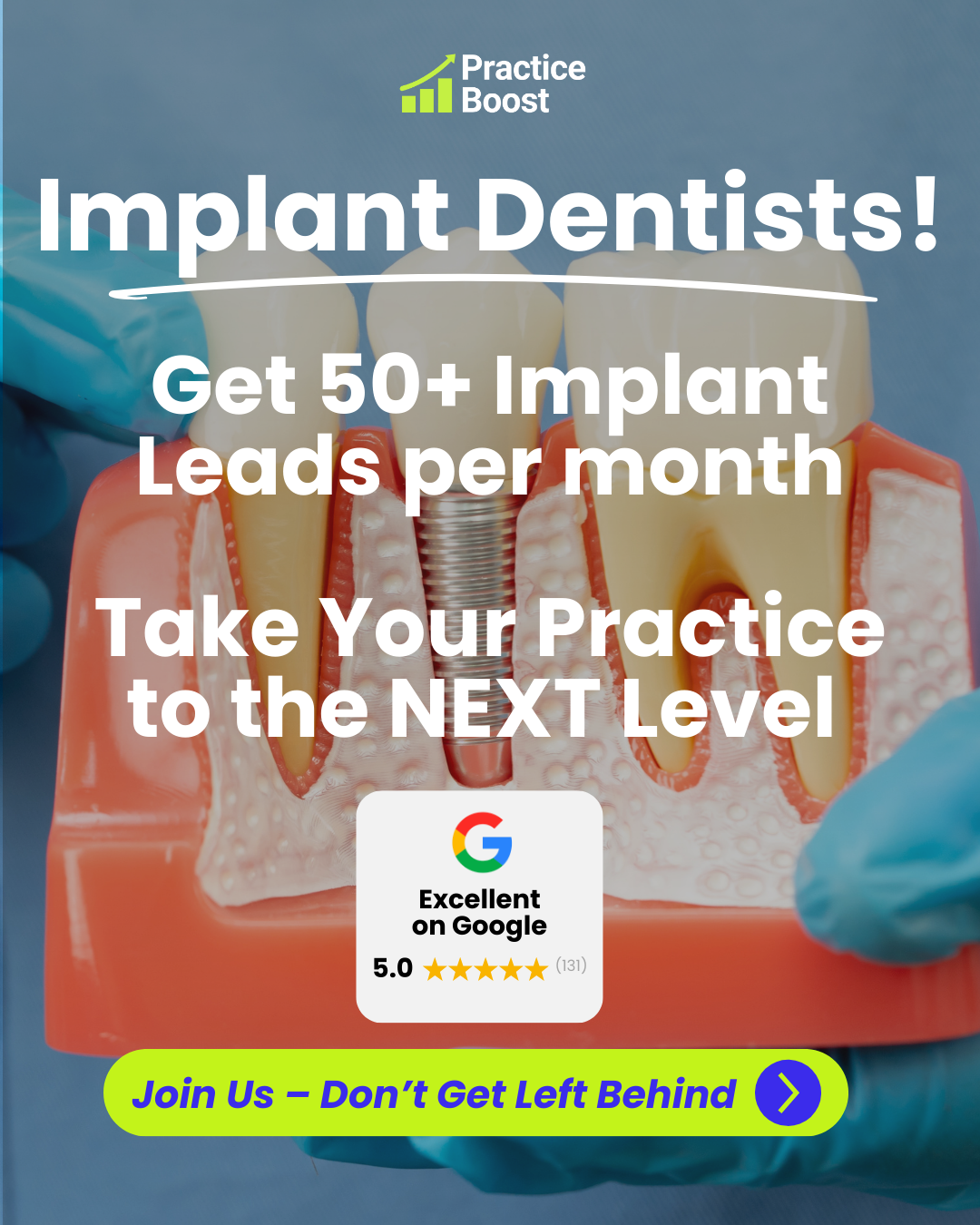 Practice Boost Facebook ad: Get More Implant Patients!