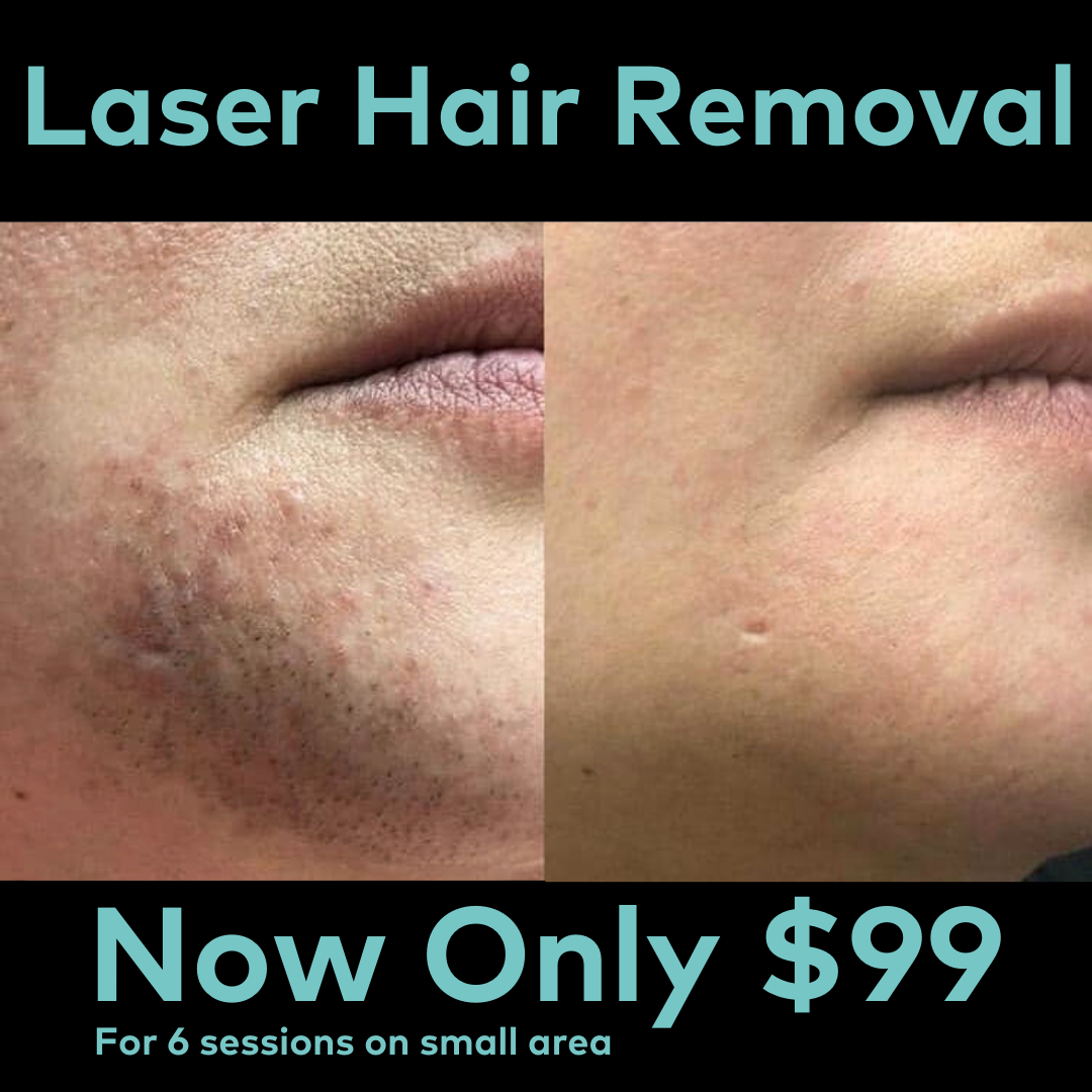 Palm Beach Laser & Aesthetic Facebook ad