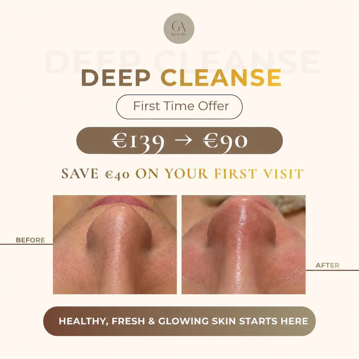 GA Skincare Facebook ad