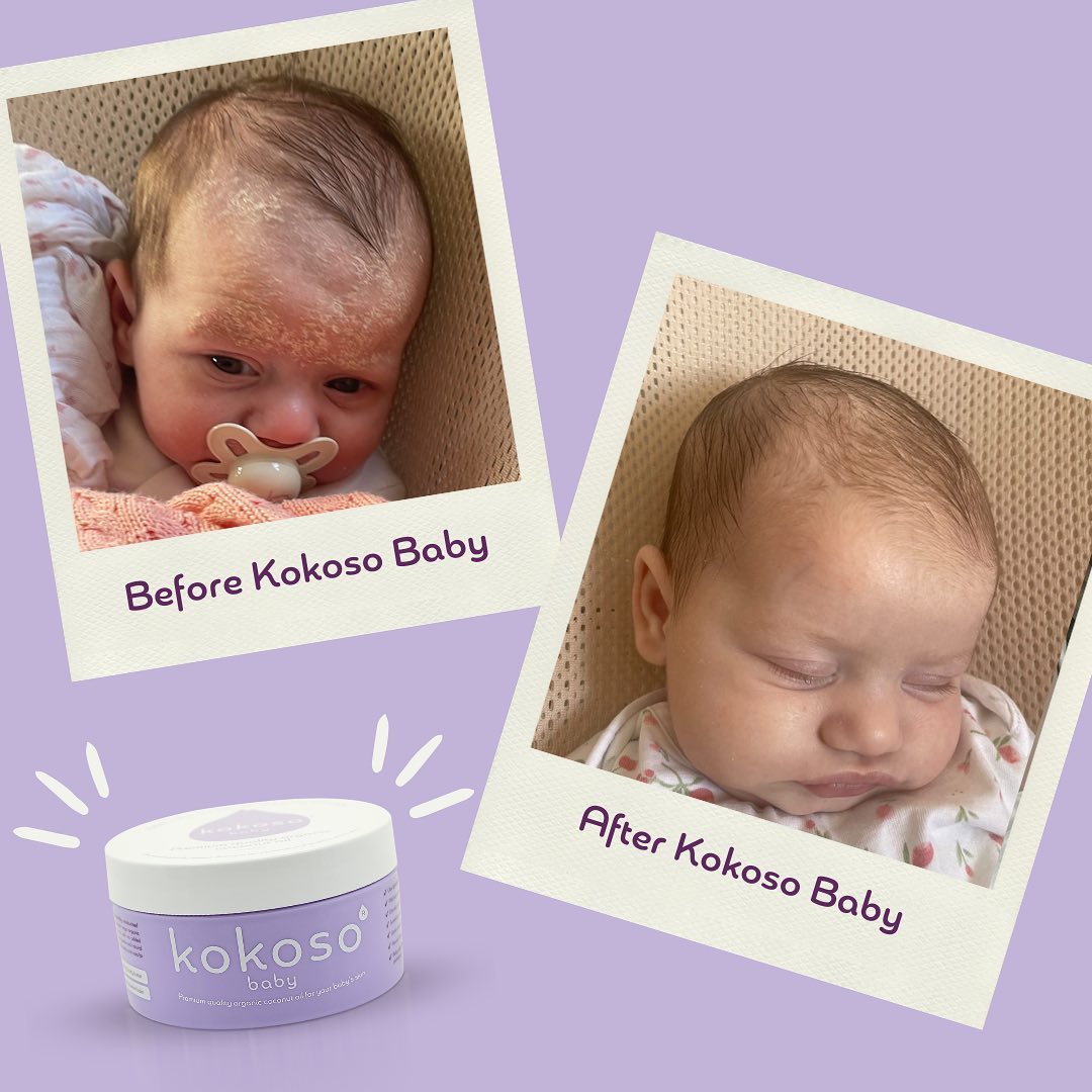 Kokoso Baby Facebook ad