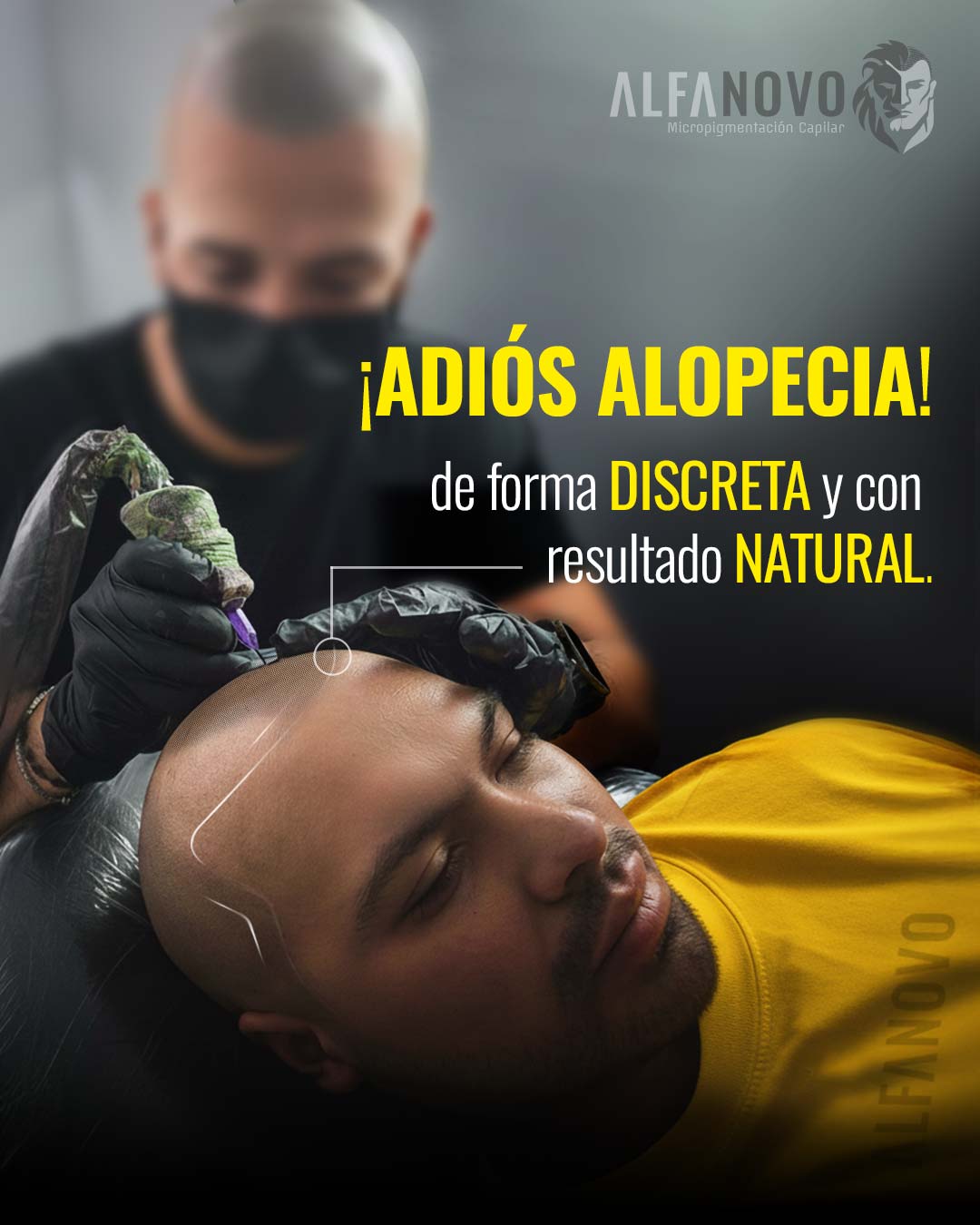 AlfaNovo Facebook ad: La micropigmentación capilar te da una imagen firme…