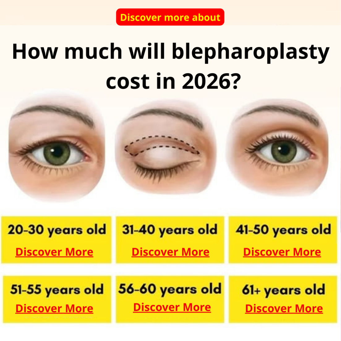 Beaumo Facebook ad: Blepharoplasty Clinics: How Much Does the Procedure Cost…