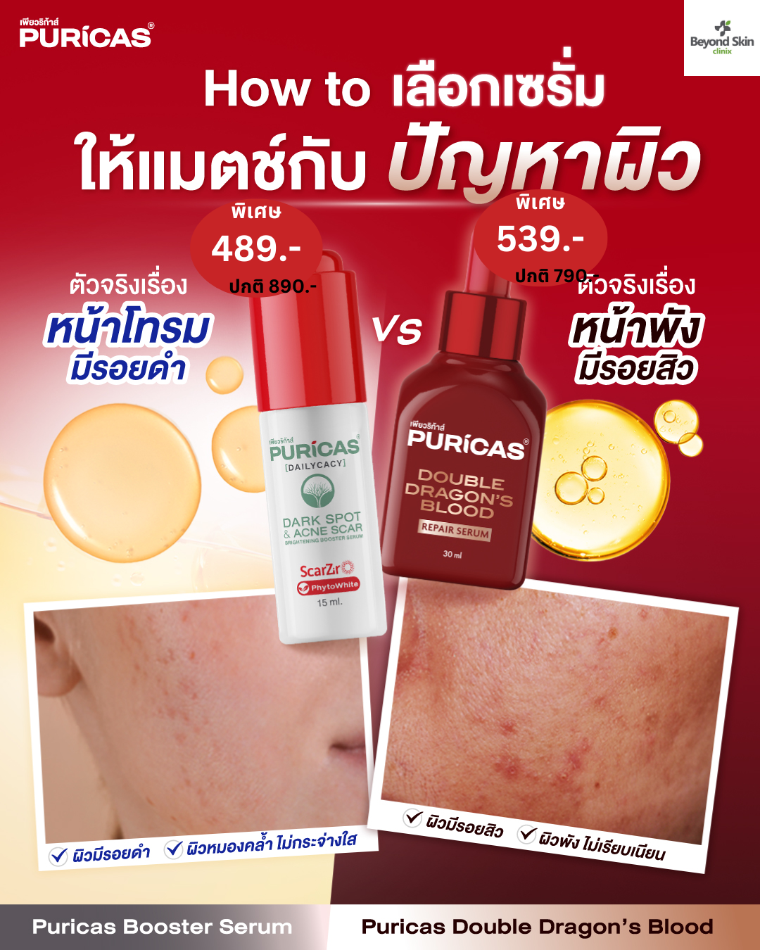 Beyond Skin Clinix Facebook ad