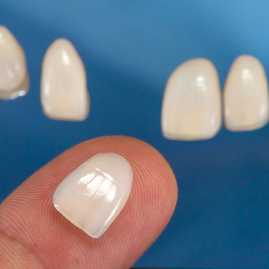 Marlton Modern Dentistry Facebook ad