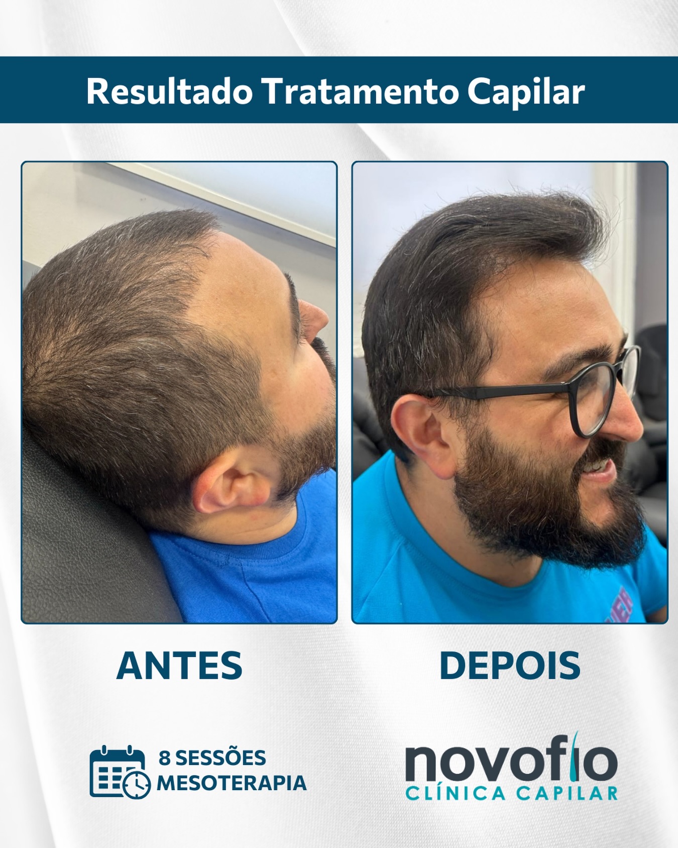 Novofio Osasco Clínica Capilar Facebook ad