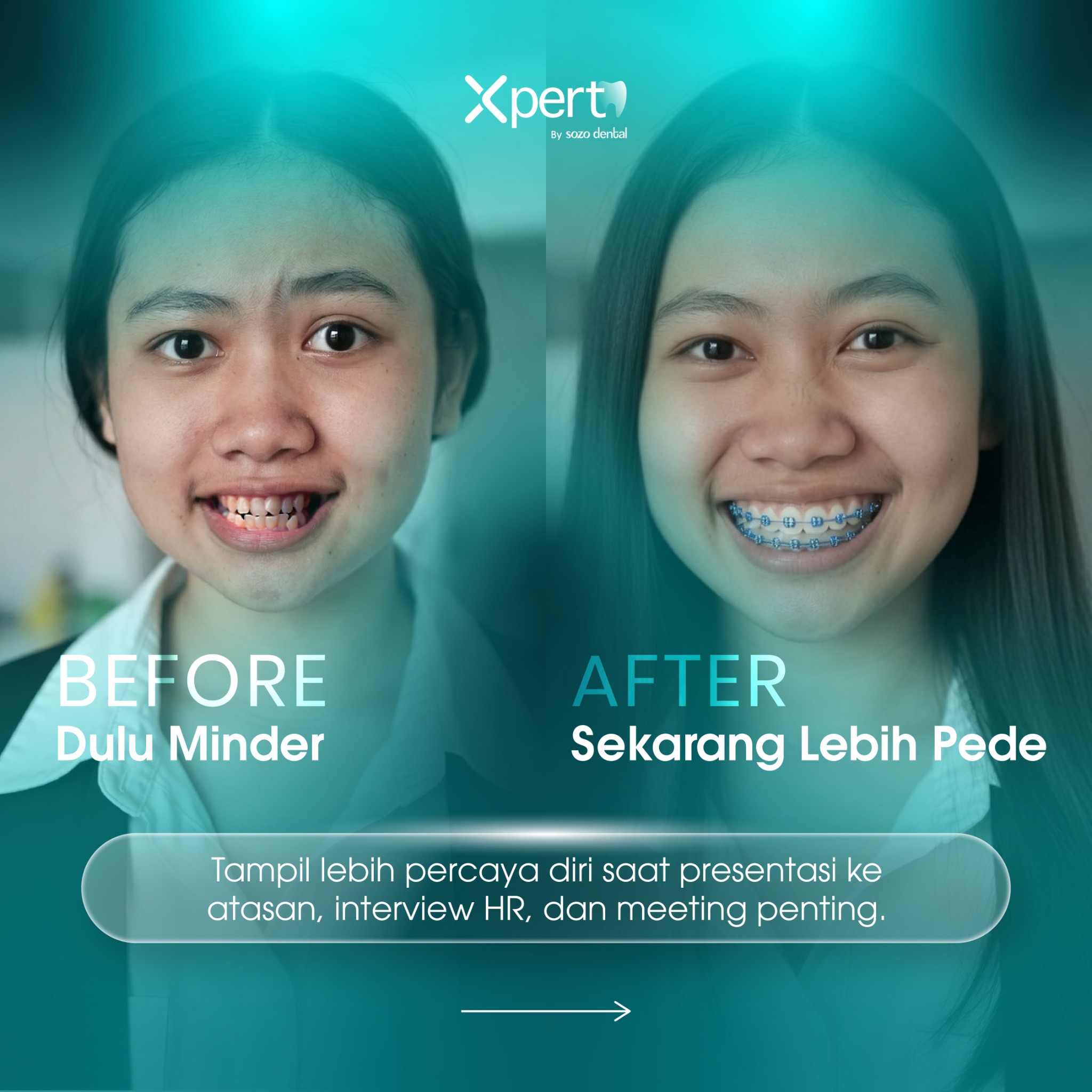 XPERT by Sozo Dental Clinic Facebook ad: Saatnya ubah penampilanmu jadi lebih profesional dan…