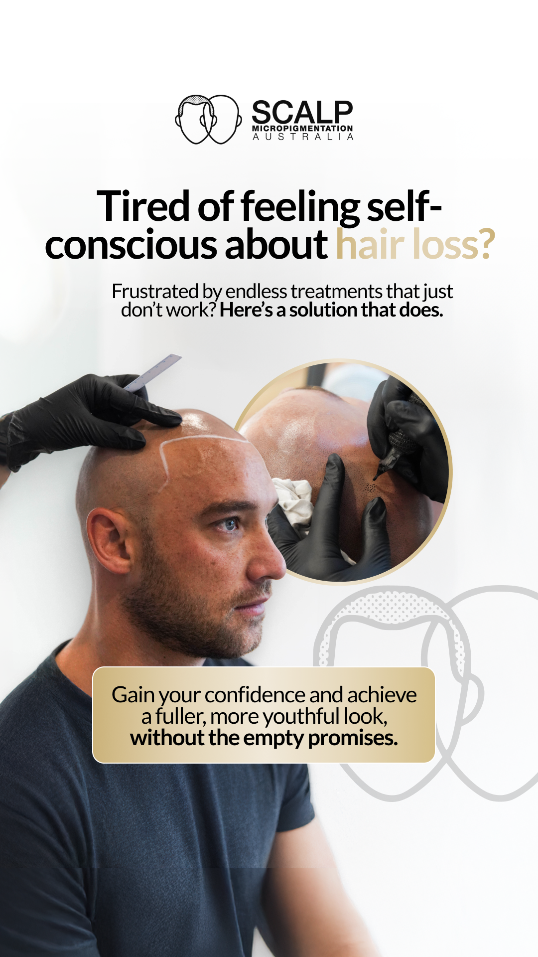 Scalp MicroPigmentation Australia Facebook ad