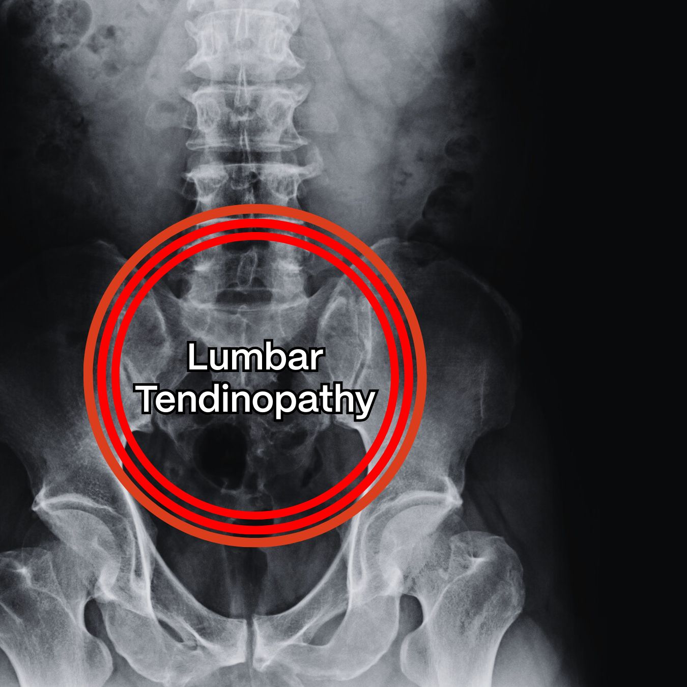 Osteva Facebook ad