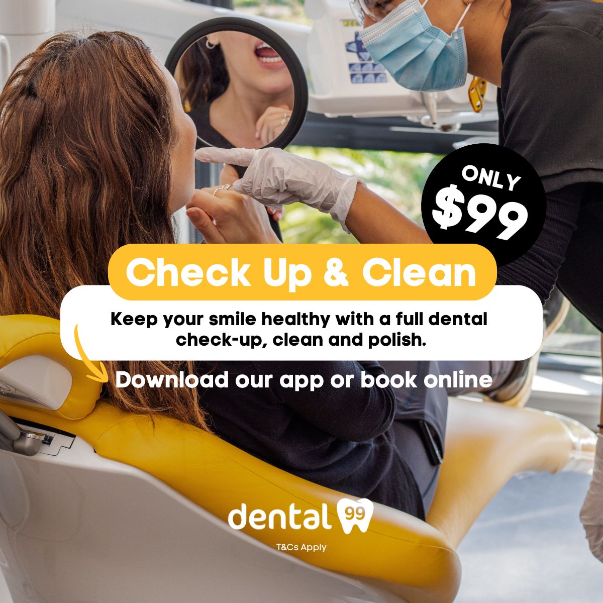 Dental 99 Facebook ad: Check-Up & Clean for $99
