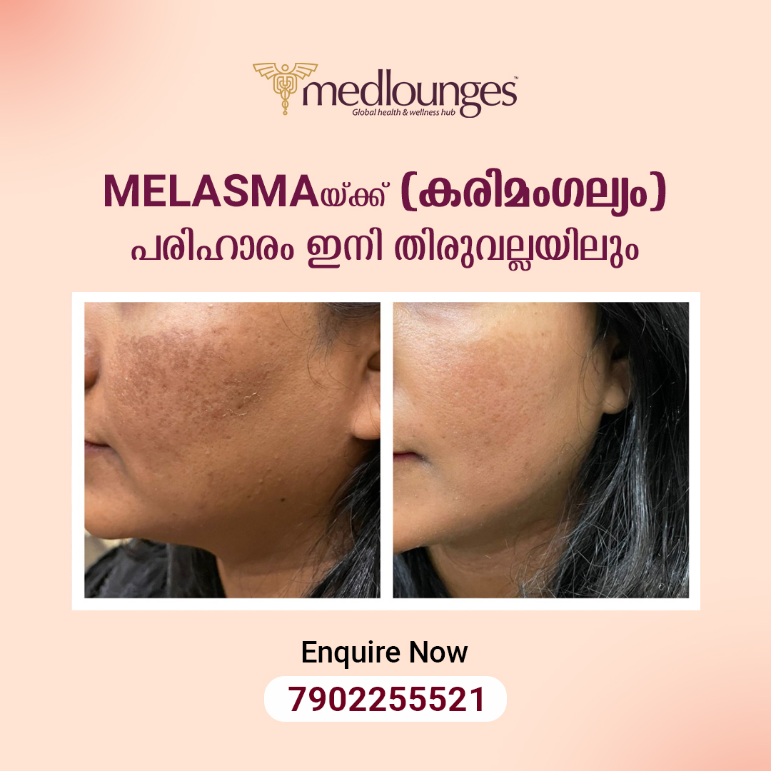 Medlounges Aesthetics Facebook ad