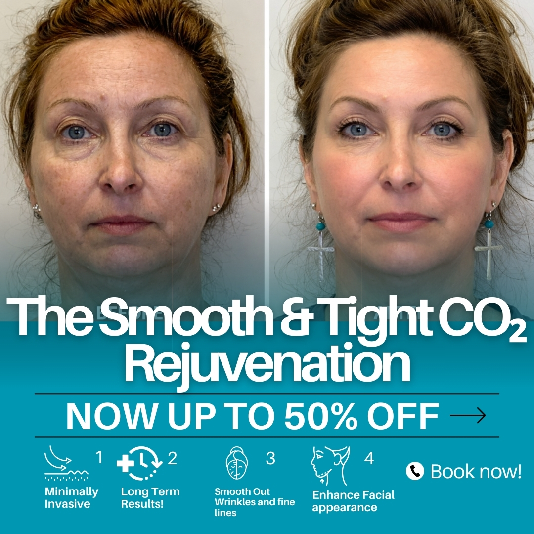 TM Aesthetics Facebook ad: London Skin Rejuvenation, Up To 50% Off CO2 Laser at TM…