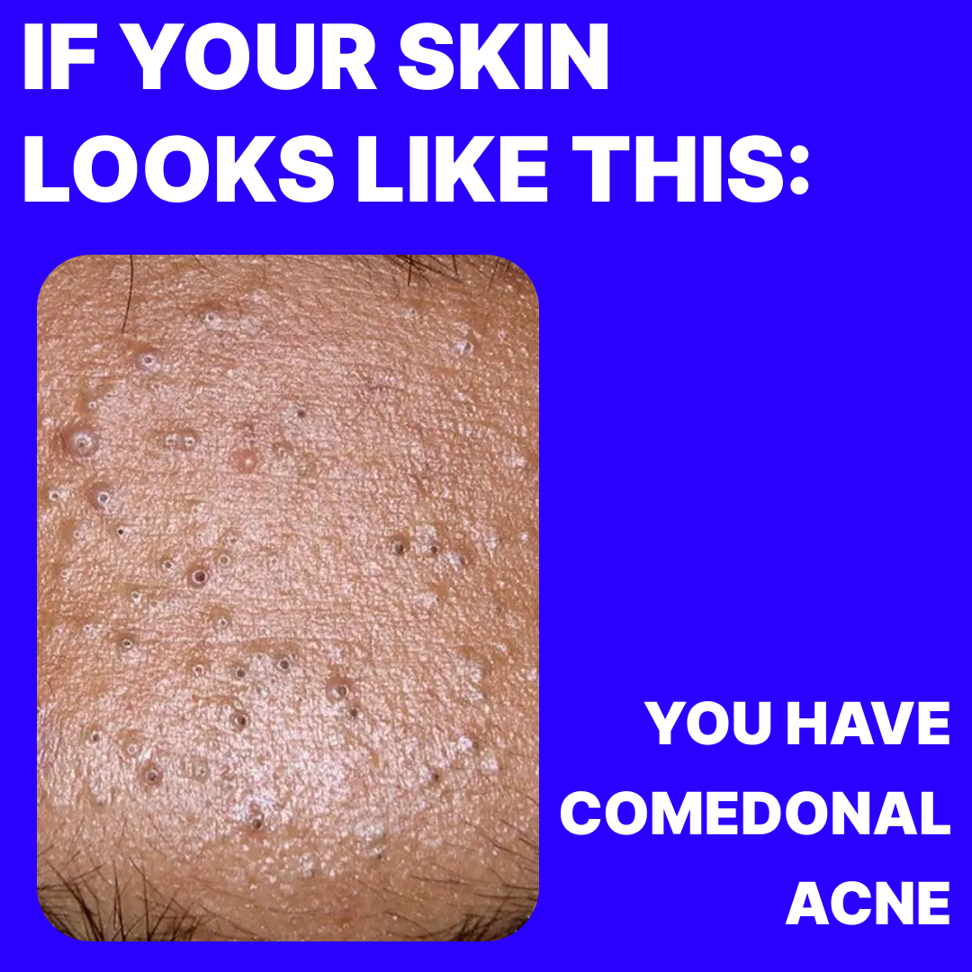 Norse Organics Facebook ad