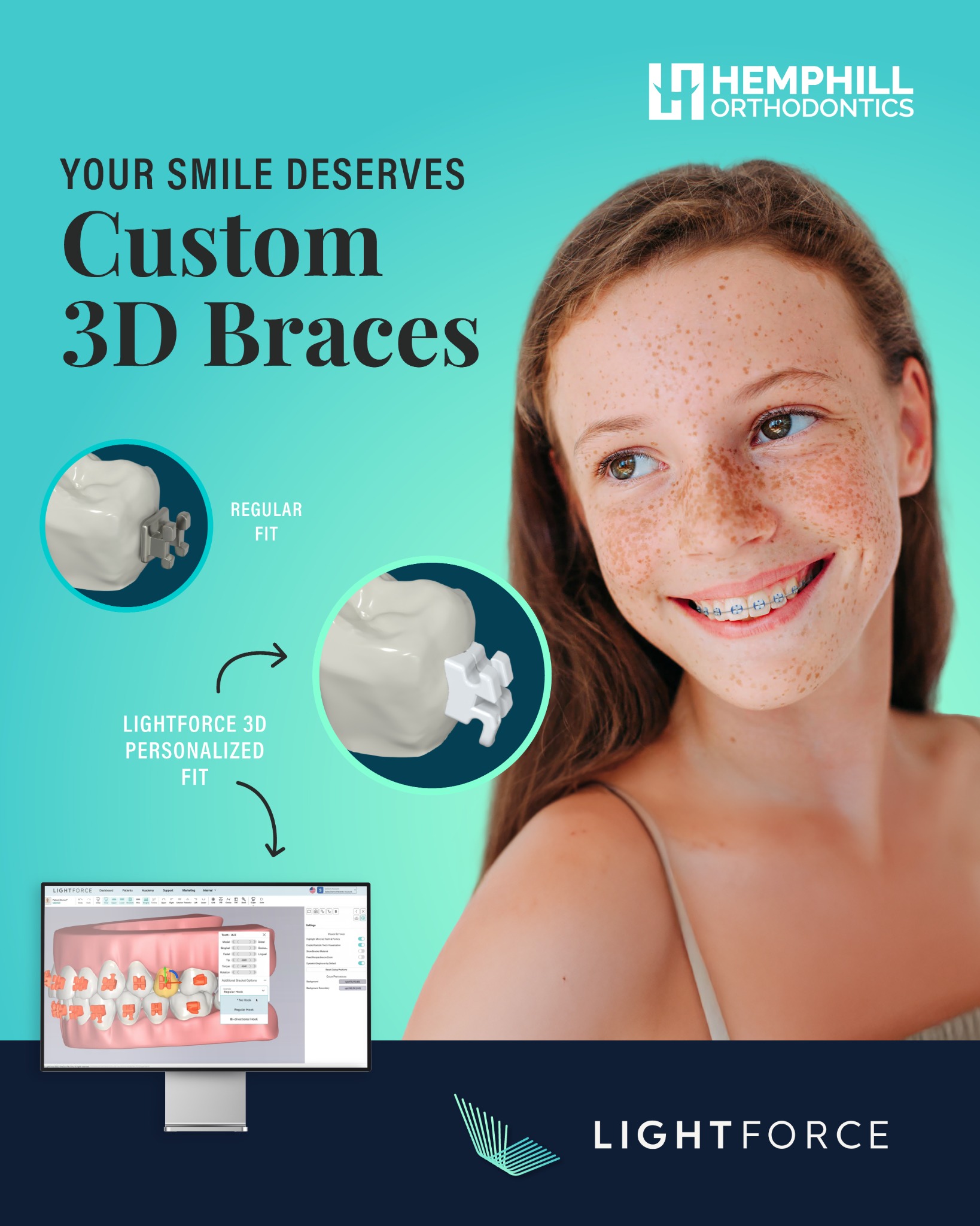 Hemphill Orthodontics Facebook ad from May 20, 2026