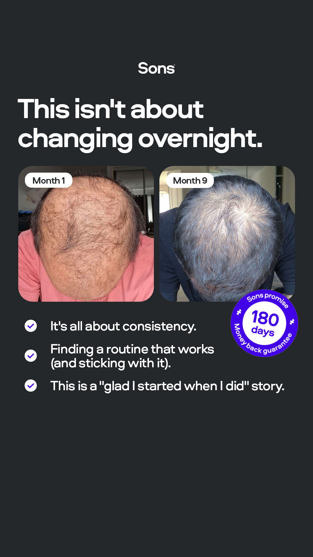 Sons Facebook ad: Your hairline. Your call.