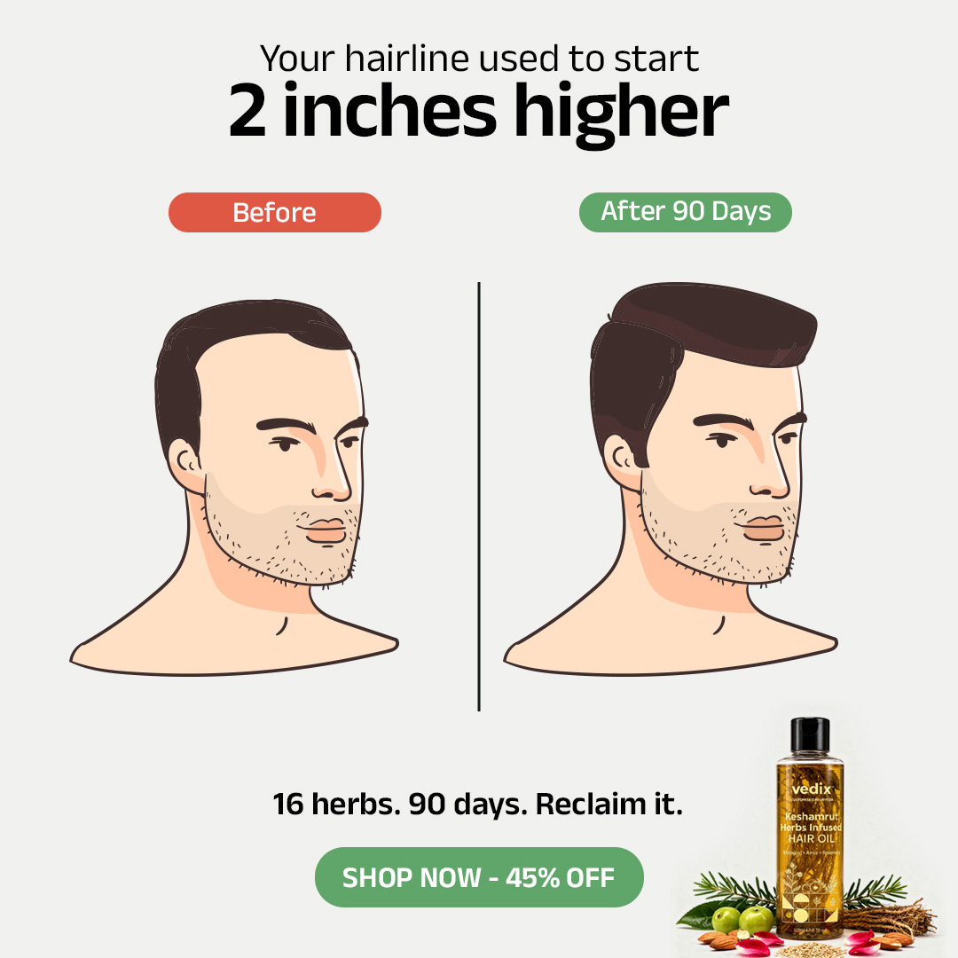 Vedix Facebook ad