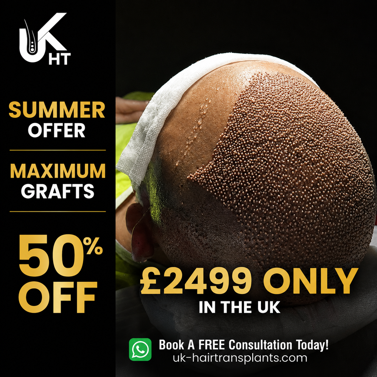 UK Hair Transplants UKHT Hair Loss Clinic Facebook ad