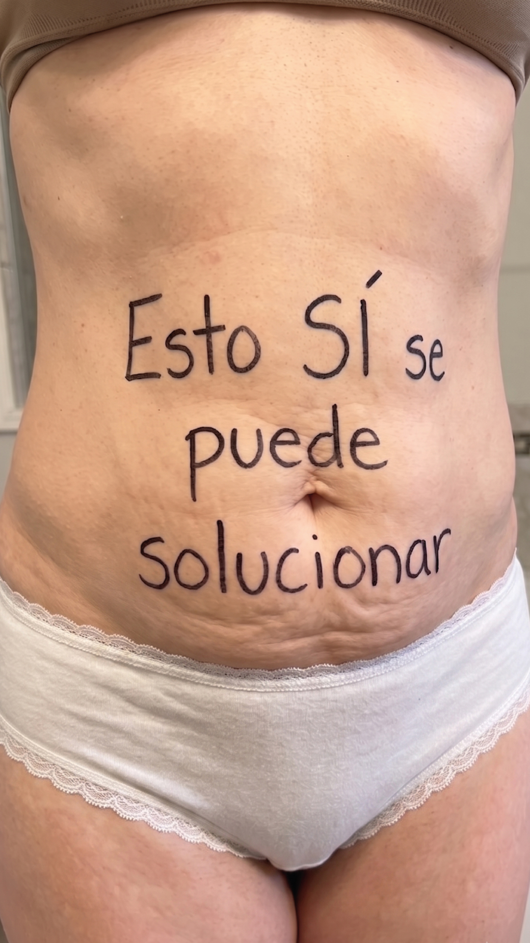 Masderm Facebook ad