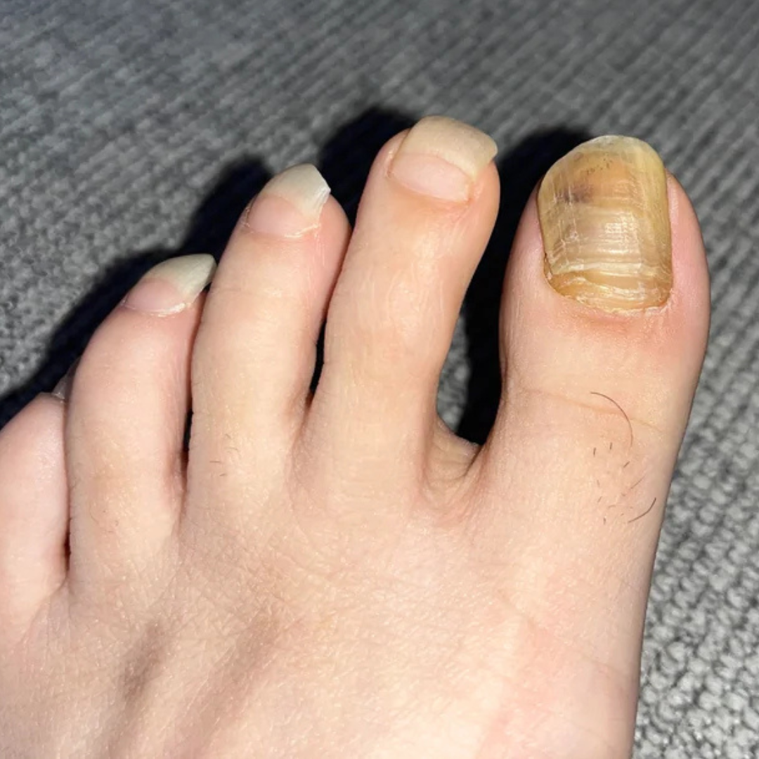 Dr. Jenna Blake, Podiatrist Facebook ad