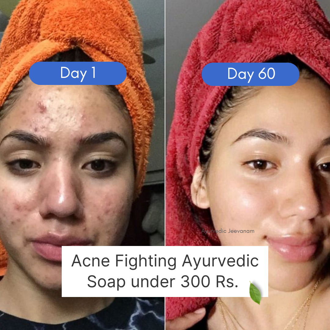 Ayurvedic Jeevanam India Facebook ad