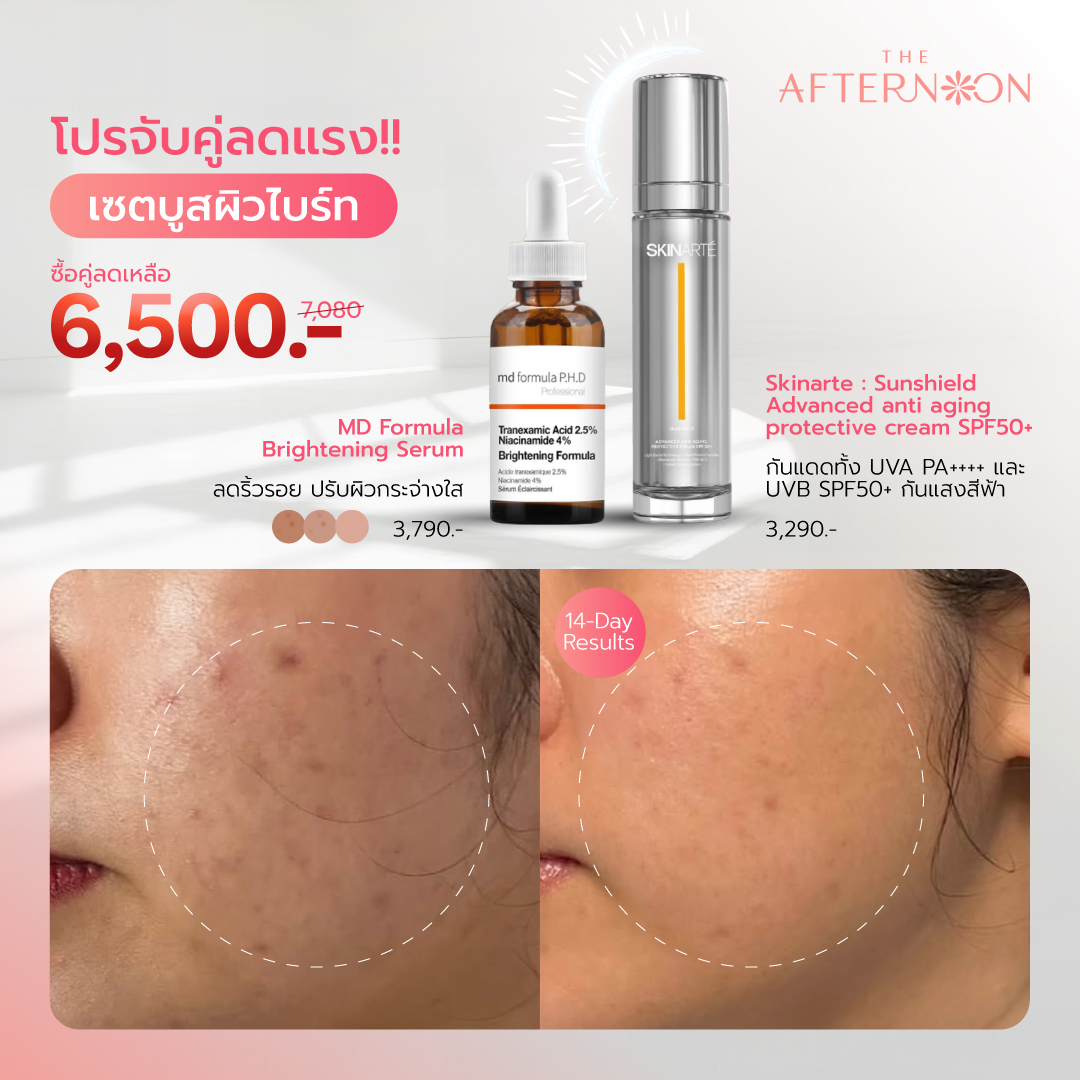 The Afternoon Facebook ad: จบปัญหาริ้วรอยและผิวหมองได้ในราคาเพียง 6,500 บาท!