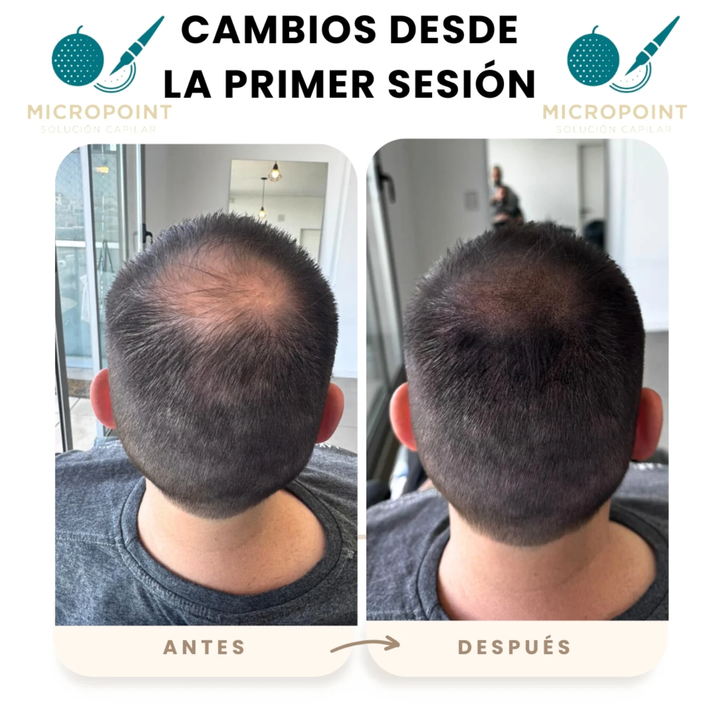 Micropointargentina Facebook ad: PRIMER SESIÓN y ya se notan los cambios.